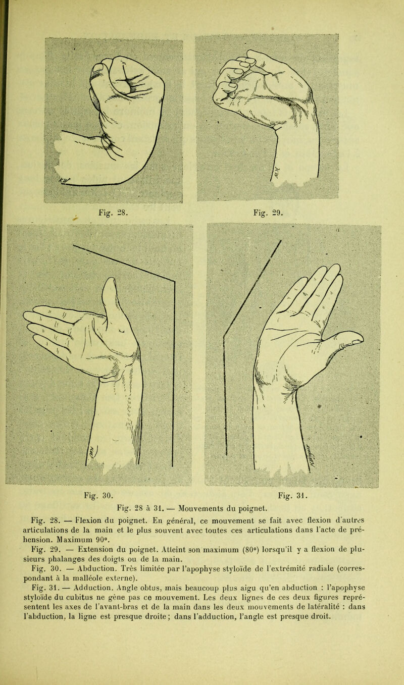 Fig. 28 à 31. — Mouvements du poignet. Fig. 28. — Flexion du poignet. En général, ce mouvement se fait avec flexion d’autres articulations de la main et le plus souvent avec toutes ces articulations dans l’acte de pré- hension. Maximum 90®. Fig. 29. — Extension du poignet. Atteint son maximum (80®) lorsqu’il y a flexion de plu- sieurs phalanges des doigts ou de la main. Fig. 30. — Abduction. Très limitée par l’apophyse stylo’ide de l’extrémité radiale (corres- pondant à la malléole externe). Fig. 31. — Adduction. Angle obtus, mais beaucoup plus aigu qu’en abduction ; l’apophyse stylo’ide du cubitus ne gène pas ce mouvement. Les deux lignes de ces deux figures repré- sentent les axes de l’avant-bras et de la main dans les deux mouvements de latéralité : dans l’abduction, la ligne est presque droite; dans l’adduction, l’angle est presque droit. Fig. 30. Fig. 31.