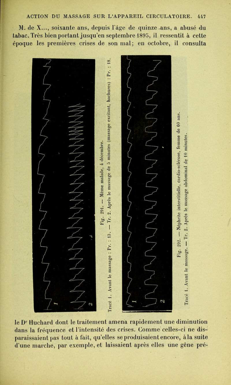 M. de X..., soixante ans, depuis Fâge de quinze-ans, a abusé du tabac. Très bien portant jusqu’en septembre 1895, il ressentit à cette époque les premières crises de son mal; en octobre, il consulta le D'‘ Huchard dont le traitement amena rapidement une diminution dans la fréquence et l’intensité des crises. Comme celles-ci ne dis- paraissaient pas tout à fait, qu’elles se produisaient encore, à la suite d’une marche, par exemple, et laissaient après elles une gêne pré-