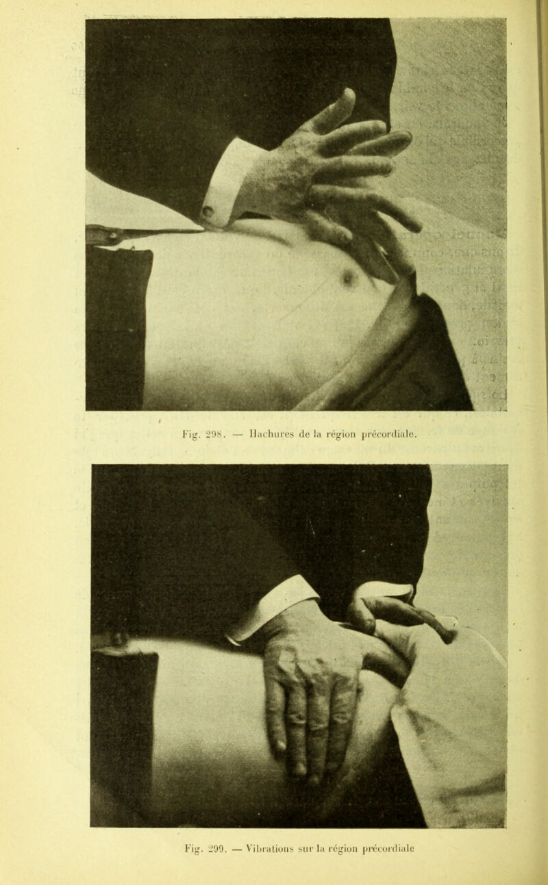 Fig. i’99. — Viljialiüiis sur lu rcgiun j)irt(jicliulc