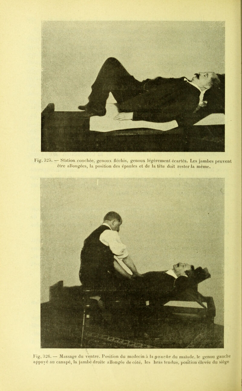 Fig. 3rJo. — Station coiicliée, genoux lléchis, g(;noux légèmnenl écartés. I.cs jambes iieuvent être allongées, la position des épaules et de la tète doit rester la même. Fig, 326.— Massage du ventre. Position du médecin à \.\ gnuchc. du malade, le genou gauclie appuyé au canapé, la jambe droite allongée de côté, les bras tendus, j)OsUion élevée du siège