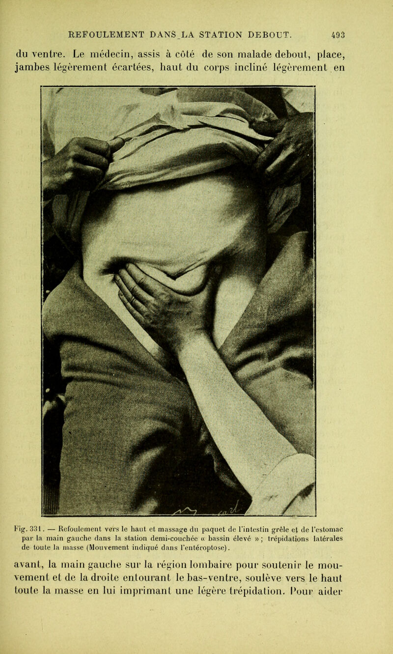 du ventre. Le médecin, assis à côté de son malade debout, place, jambes légèrement écartées, haut du corps incliné légèrement en Fig. .331. — Refoulement vers le haut et massage du paquet de l’intestin grêle et de l’estomac par la main gauche dans la station demi-couchée « bassin élevé » ; trépidations latérales de toute la masse (Mouvement indiqué dans l'entéroptose). avant, la main gauche sur la région lombaire pour soutenir le mou- vement et de la droite entourant le bas-ventre, soulève vers le haut toute la masse en lui imprimant une légère trépidation. I^our aider