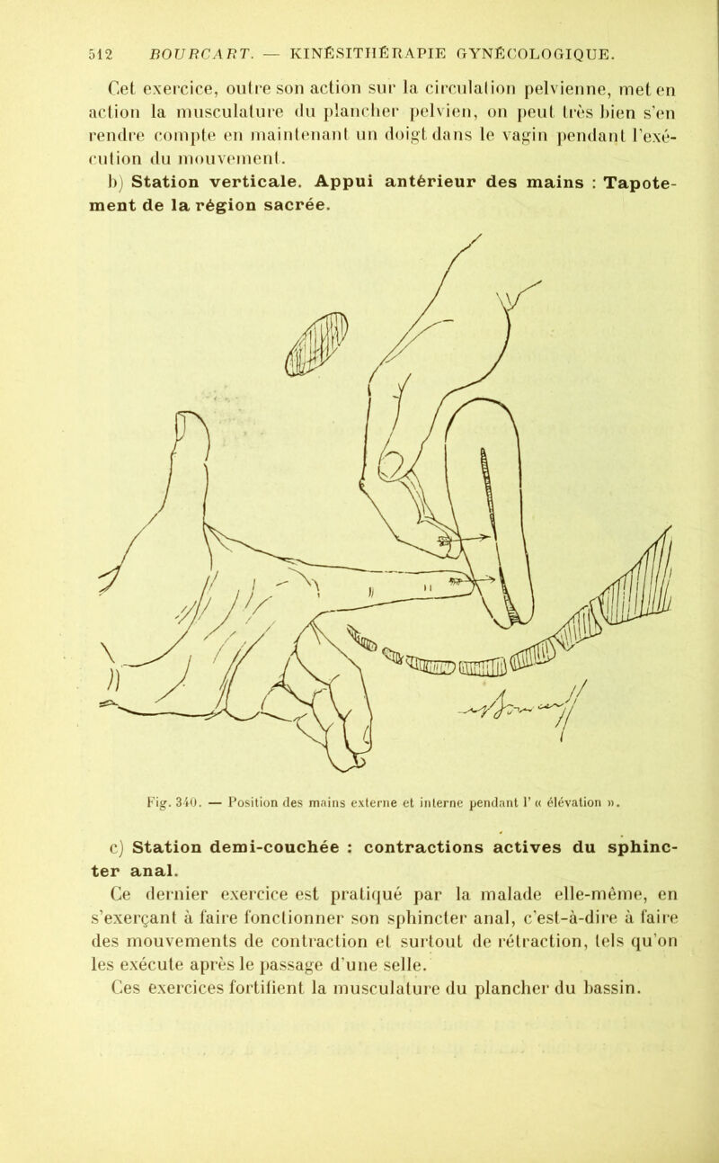Cet exercice, ouireson action sur la circulalion pelvienne, met en action la nuisculalure du plancher pelvien, on peut très bien s’en rendre compte en maintenant un doigt dans le vagin |)endant l’exé- cntion du mouvement. l)j Station verticale. Appui antérieur des mains : Tapote- ment de la région sacrée. c) Station demi-couchée : contractions actives du sphinc- ter anal. Ce dernier exercice est pratiqué par la malade elle-même, en s’exerçant à faire fonctionner son sphincter anal, c’est-à-dire à faii’e des mouvements de contraction et sui tout de rétraction, tels qu’on les exécute après le passage d’une selle. Ces exercices fortifient la musculature du plancher du bassin.