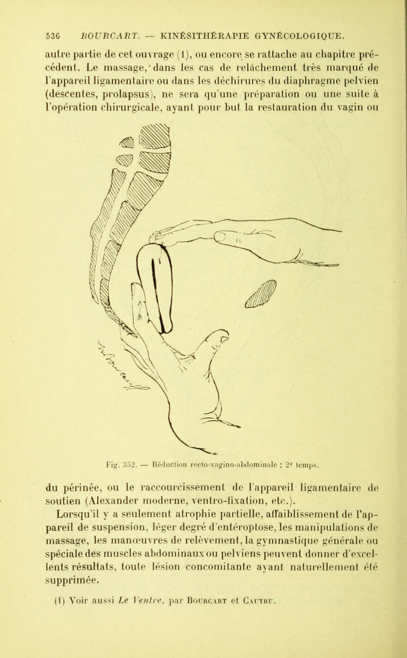 autre partie de cet ouvrage (1), ou encore se rattache au chapitre pré- cédent. Le massage,*dans les cas de relâchement très marqué de l’appareil ligamentaire ou dans les déchirures du diaphragme pelvien (descentes, prolapsus), ne sera qu’une préparation ou une suite à l’opération chirurgicale, ayant pour but ta restauration du vagin ou du périnée, ou le raccourcissement de l’appareil ligamentaire de soutien (Alexander moderne, ventro-lixation, etc.). Lorsqu’il y a seulement atrophie partielle, affaiblissement de l’ap- pareil de suspension, léger degré d’entéroptose, les manipulations de massage, les manœuvres de relèvement, la gymnastique générale ou spéciale des muscles abdominaux ou pelviens peuvent donner d’excel- lents résultats, toute lésion concomitante ayant naturellement été supprimée. (1) Voir aussi Le Ventre, par Bourcart et Cactrc.