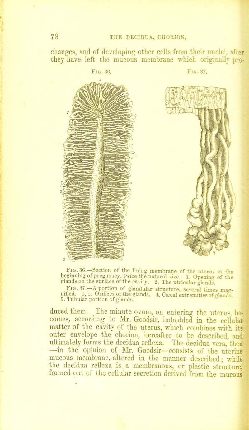 changes, and of developing other cells from their nuclei, after they have left the mucous membrane which originally pro- Fig. 30. Fig. 37. Fig. 36.—Section of the lining membrane of the uterus at the beginning of pregnancy, twice the natural size. 1. Opening of the glands on the surface of the cavity. 2. The utricular glands. _ Fig. 37.—A portion of glandular structure, several times mag- nified. 1,1. Orifices of the glands. 4. Caecal extremities of glands. 5. Tubular portion of glands. duced them. The minute ovum, on entering the uterus, be- comes, according to Mr. Goodsir, imbedded in the cellular matter of the cavity of the uterus, which combines with its outer envelope the chorion, hereafter to be described, and ultimately forms the decidua reflexa. The decidua vera, then —in the opinion of Mr. Goodsir—consists of the uterine mucous membrane, altered in the manner described; while the decidua reflexa is a membranous, or plastic structure, formed out of the cellular secretion derived from the mucous