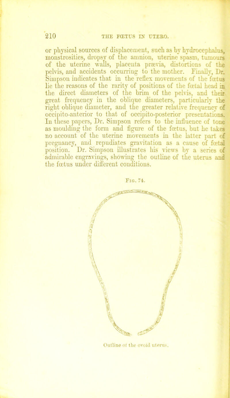 or physical sources of displacement, such as by hydrocephalus, monstrosities, dropsy of the amnion, uterine spasm, tumours of the uterine walls, placenta prsevia, distortions of the pelvis, and accidents occurring to the mother. Finally, Dr. Simpsou indicates that in the reflex movements of the feetus lie the reasons of the rarity of positions of the fcetal head in the direct diameters of the brim of the pelvis, and their great frequency in the oblique diameters, particularly the right oblique diameter, and the greater relative frequency of occipito-anterior to that of occipito-posterior presentations. In these papers, Dr. Simpson refers to the influence of tone as moulding the form and figure of the foetus, but he tabes no account of the uterine movements in the latter part of pregnancy, and repudiates gravitation as a cause of fcetal position. Dr. Simpson illustrates his views by a series of admirable engravings, showing the outline of the uterus and the foetus under different conditions. Fig.74. Outline ol the ovoid uterus.