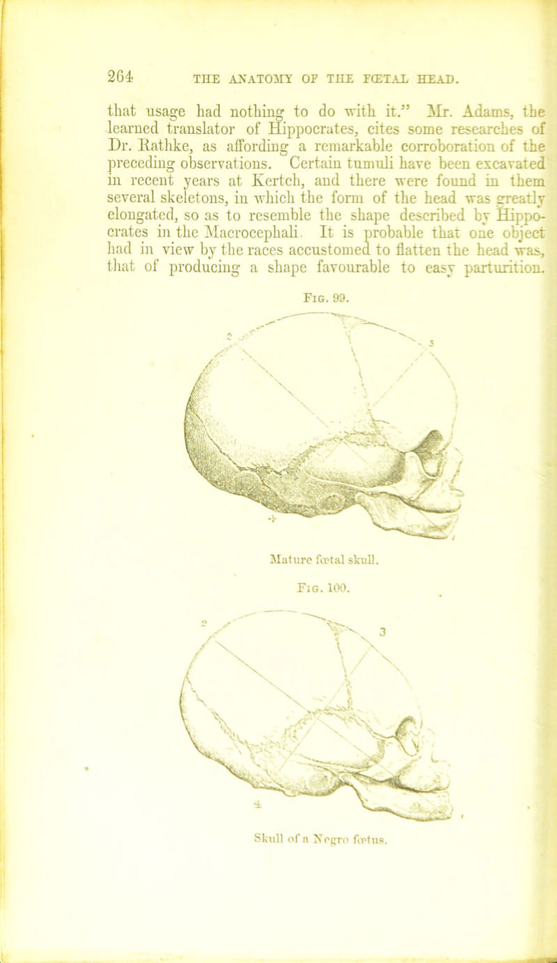 that usage had nothing to do with it.” Mr. Adams, the learned translator of Hippocrates, cites some researches of Hr. Rathke, as affording a remarkable corroboration of the preceding observations. Certain tumuli have been excavated in recent years at Kertch, and there were found in them several skeletons, in which the form of the head was greatly elongated, so as to resemble the shape described by Hippo- crates in the Macrocephali It is probable that one object had in view by the races accustomed to flatten the head was, that of producing a shape favourable to easy parturition. Fig. 99. Mature foetal skull. Fig. 100. Skull of n Nogro foetus.