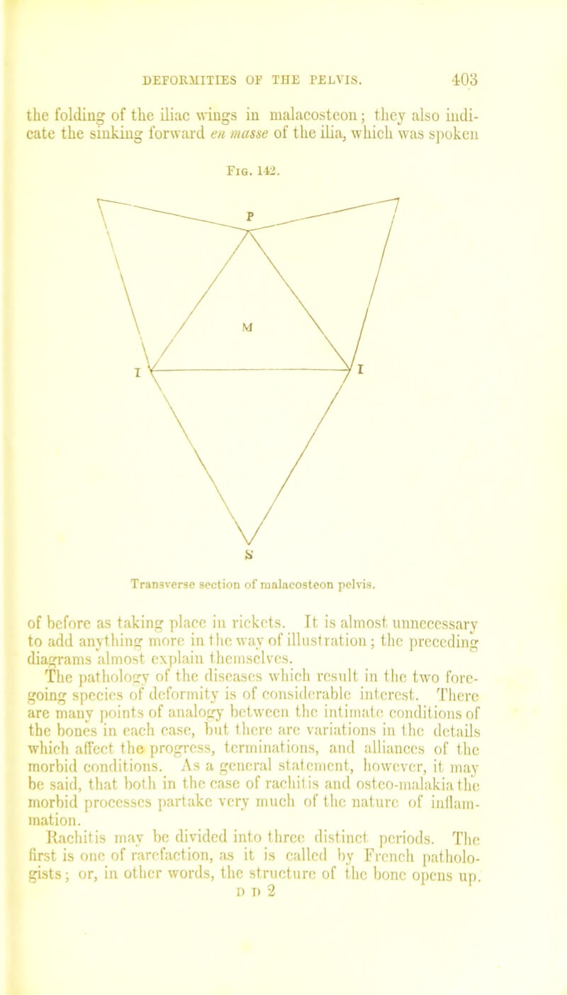 the folding of the iliac wings in malacosteon; they also indi- cate the sinking forward e/t masse of the ilia, which was spoken Fig. 142. Transverse section of malacosteon pelvis. of before as taking place in rickets. It is almost unnecessary to add anything more in the way of illustration; the preceding diagrams almost explain themselves. The pathology of the diseases which result in the two fore- going species of deformity is of considerable interest. There are many points of analogy between the intimate conditions of the bones in each case, but there are variations in the details which affect the progress, terminations, and alliances of the morbid conditions. As a general statement, however, it may be said, that both in the case of rachitis and osteo-malakia the morbid processes partake very much of the nature of inflam- mation. Rachitis may be divided into three distinct, periods. The first is one of rarefaction, as it is called by French patholo- gists; or, in other words, the structure of the bone opens up. d n 2