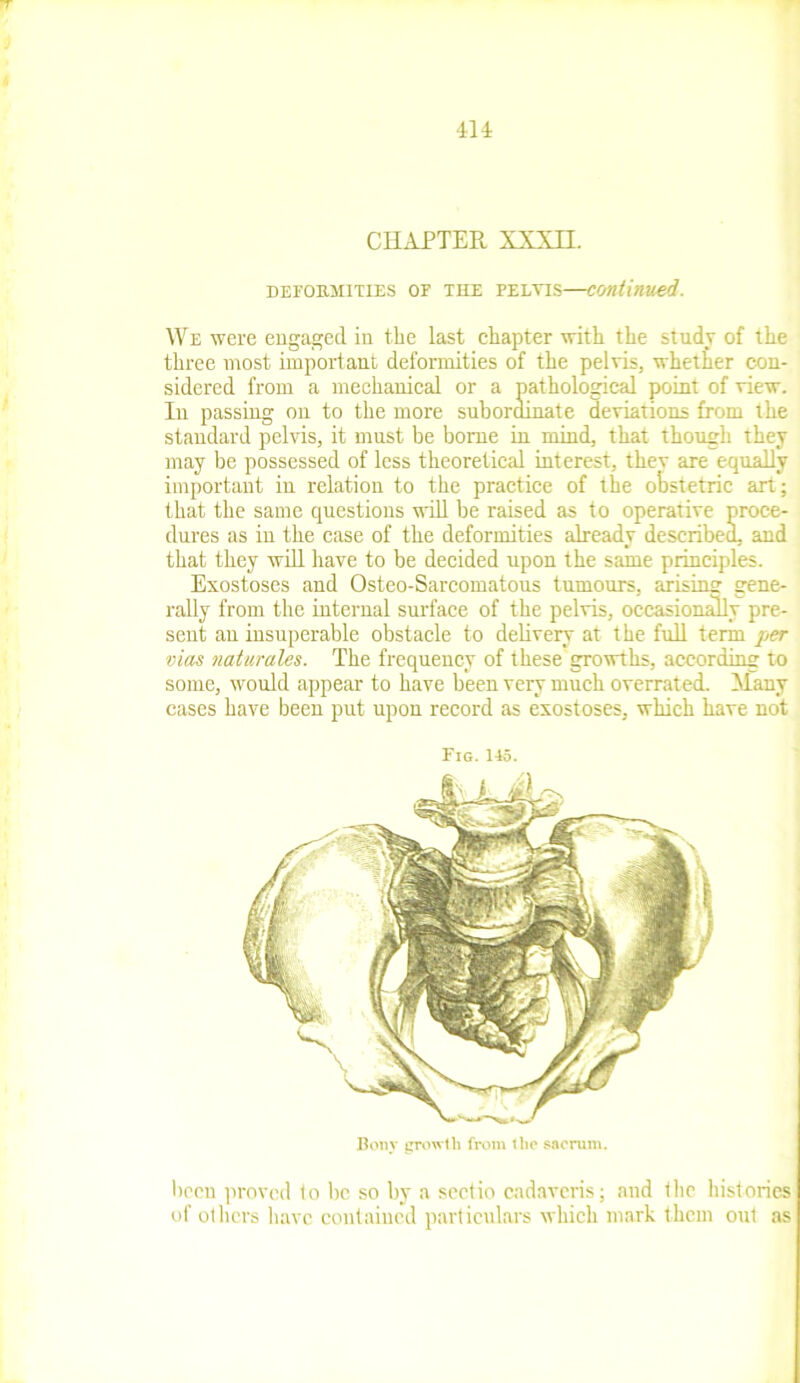 CHAPTER XXXII. defohmities of the pelvis—continued. We were engaged in the last chapter with the study of the three most important deformities of the pelvis, whether con- sidered from a mechanical or a pathological point of view. In passing on to the more subordinate deviations from the standard pelvis, it must be borne in mind, that though they may be possessed of less theoretical interest, thev are equally important in relation to the practice of the obstetric art ; that the same questions will be raised as to operative proce- dures as in the case of the deformities already described, and that they will have to be decided upon the same principles. Exostoses and Osteo-Sarcomatous tumours, arisimr gene- rally from the internal surface of the pelvis, occasionally pre- sent an insuperable obstacle to delivery at the full term per vias naturales. The frequency of these growths, according to some, would appear to have been very much overrated. Many cases have been put upon record as exostoses, which have not Fig. 145. Bony growth from the sacrum. been proved to be so by a sectio cadaveris; and the histories of others have contained particulars which mark them out as