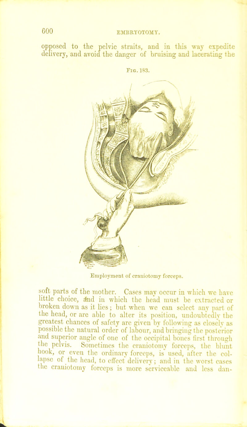 GOO EJEBKYOTOJIY. opposed to the pelvic straits, and in this way expedite delivery, and avoid the danger of bruising and lacerating the Fig.183. Employment of craniotomy forceps. soft parts of the mother. Cases may occur in which we have little choice, dud in which the head must be extracted or broken dowu as it lies; but when we can select any part of the head, or are able to alter its position, undoubtedly the greatest chances of safety are given by following as closelv as possible the natural order of labour, and bringing the posterior and superior angle of one of 1 he occipital bones first through the pelvis. Sometimes the craniotomy forceps, the blunt hook, or even the ordinary forceps, is used, after the col- lapse of the head, to effect delivery; and in the worst cases the craniotomy forceps is more serviceable and less dan-