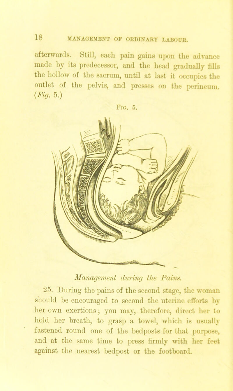 afterwards. Still, each pain gains upon the advance made by its predecessor, and the head gradually fills the hollow of the sacrum, until at last it occupies the outlet of the pelvis, and presses on the perineum. (Fig. 5.) Fm. 5. Management chiring the Pains. 25. During the pains of the second stage, the woman should be encouraged to second the uterine efforts by her own exertions; you may, therefore, direct her to hold her breath, to grasp a towel, which is usually fastened round one of the bedposts for that purpose, and at the same time to press firmly with her feet against the nearest bedpost or the footboard.