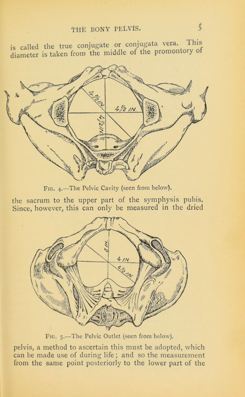 is called the true conjugate diameter is taken from the m or conjugata vera. 1 his iddle of the promontory of the sacrum to the upper part of the symphysis pubis. Since, however, this can only be measured in the dried pelvis, a method to ascertain this must be adopted, which can be made use of during life; and so the measurement from the same point posteriorly to the lower part of the