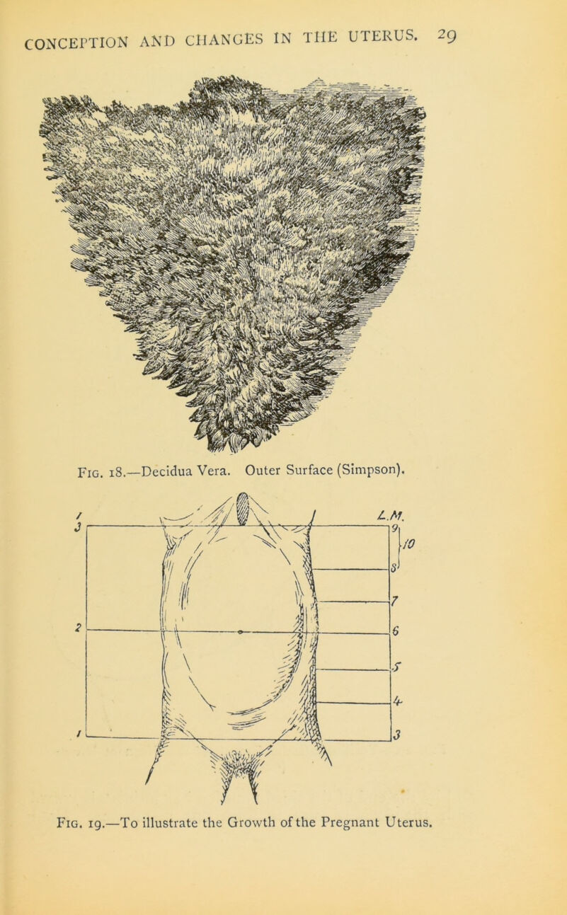 Fig. 18.—Decidua Vera. Outer Surface (Simpson).