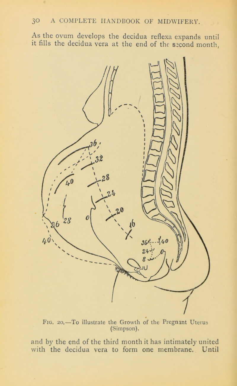 As the ovum develops the decidua reflexa expands until it fills the decidua vera at the end of the second month, Fig. 20.—To illustrate the Growth of the Pregnant Uterus (Simpson). and by the end of the third month it has intimately united with the decidua vera to form one membrane. Until