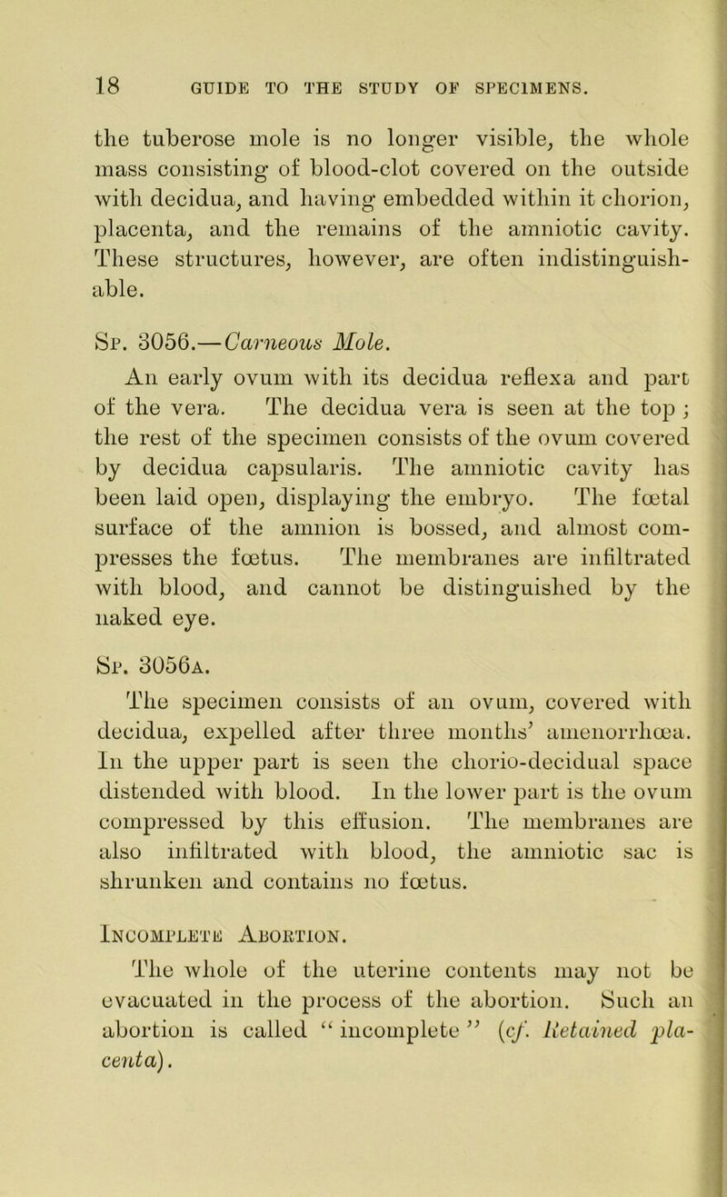 the tuberose mole is no longer visible, the whole mass consisting of blood-clot covered on the outside with decidua, and having embedded within it chorion, placenta, and the remains of the amniotic cavity. These structures, however, are often indistinguish- able. Sp. 3056.—Carneou* Mole. An early ovum with its decidua reflexa and part of the vera. The decidua vera is seen at the top ; the rest of the specimen consists of the ovum covered by decidua capsularis. The amniotic cavity has been laid open, displaying the embryo. The foetal surface of the amnion is bossed, and almost com- presses the foetus. The membranes are infiltrated with blood, and cannot be distinguished by the naked eye. Sp. 3056a. The specimen consists of an ovum, covered with decidua, expelled after three months' amenorrlicea. In the upper part is seen the cliorio-decidual space distended with blood. In the lower part is the ovum compressed by this effusion. The membranes are also infiltrated with blood, the amniotic sac is shrunken and contains no foetus. Incomplete Abortion. The whole of the uterine contents may not be evacuated in the process of the abortion. Such an abortion is called “ incomplete (c/. Retained pla- centa) .