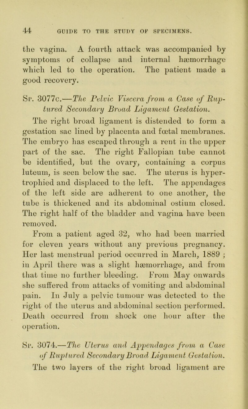the vagina. A fourth attack was accompanied by symptoms of collapse and internal haemorrhage which led to the operation. The patient made a good recovery. Sp. 3077c.—The Pelvic Viscera from a Case of Rup- tured Secondary Broad Ligament Gestation. The right broad ligament is distended to form a gestation sac lined by placenta and foetal membranes. The embryo has escaped through a rent in the upper part of the sac. The right Fallopian tube cannot be identified, but the ovary, containing a corpus luteum, is seen below the sac. The uterus is hyper- trophied and displaced to the left. The appendages of the left side are adherent to one another, the tube is thickened and its abdominal ostium closed. The right half of the bladder and vagina have been removed. From a patient aged 32, who had been married for eleven years without any previous pregnancy. Her last menstrual period occurred in March, 1889 ; in April there was a slight haemorrhage, and from that time no further bleeding. From May onwards she suffered from attacks of vomiting and abdominal pain. In July a pelvic tumour was detected to the right of the uterus and abdominal section performed. Death occurred from shock one hour after the operation. Sp. 3074.—The Uterus and, Appendages from a Case if Ruptured Secondary Broad. Ligament Gestation. The two layers of the right broad ligament are