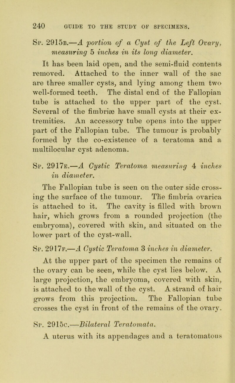 Sp. 2915b.—A portion of a Cyst of the Left Ovary, measuring 5 inches in its long diameter. It has been laid open, and the semi-fluid contents removed. Attached to the inner wall of the sac are three smaller cysts, and lying among them two well-formed teeth. The distal end of the Fallopian tube is attached to the upper part of the cyst. Several of the fimbriae have small cysts at their ex- tremities. An accessory tube opens into the upper part of the Fallopian tube. The tumour is probably formed by the co-existence of a teratoma and a multilocular cyst adenoma. Sp. 2917e.—A Cystic Teratoma measuring 4 inches in diameter. The Fallopian tube is seen on the outer side cross- ing the surface of the tumour. The fimbria ovarica is attached to it. The cavity is filled with brown hair, which grows from a rounded projection (the embryoma), covered with skin, and situated on the lower part of the cyst-wall. Sp. 2917f.—A Cystic Teratoma 3 inches in diameter. At the upper part of the specimen the remains of the ovary can be seen, while the cyst lies below. A large projection, the embryoma, covered with skin, is attached to the wall of the cyst. A strand of hair grows from this projection. The Fallopian tube crosses the cyst in front of the remains of the ovary. Sp. 2915c.—Bilateral Teratomata. A uterus with its appendages and a teratomatous