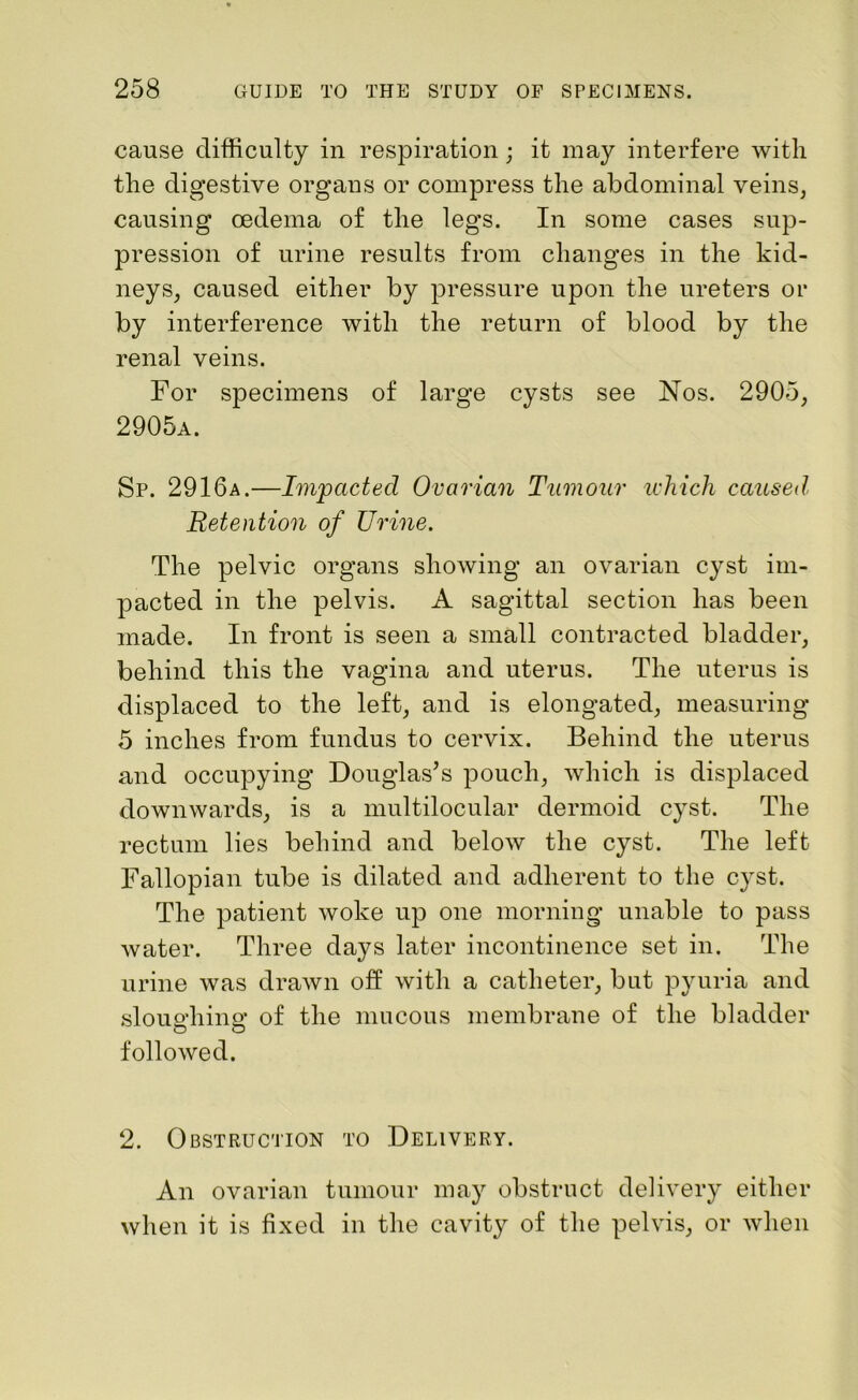 cause difficulty in respiration; it may interfere with the digestive organs or compress the abdominal veins, causing oedema of the legs. In some cases sup- pression of urine results from changes in the kid- neys, caused either by pressure upon the ureters or by interference with the return of blood by the renal veins. For specimens of large cysts see Nos. 2905, 2905a. Sp. 2916a.—Impacted Ovarian Tumour which caused, Retention of Urine. The pelvic organs showing an ovarian cyst im- pacted in the pelvis. A sagittal section has been made. In front is seen a small contracted bladder, behind this the vagina and uterus. The uterus is displaced to the left, and is elongated, measuring 5 inches from fundus to cervix. Behind the uterus and occupying Douglas’s pouch, which is displaced downwards, is a multilocular dermoid cyst. The rectum lies behind and below the cyst. The left Fallopian tube is dilated and adherent to the cyst. The patient woke up one morning unable to pass water. Three days later incontinence set in. The urine was drawn off with a catheter, but pyuria and sloughing of the mucous membrane of the bladder O O followed. 2. Obstruction to Delivery. An ovarian tumour may obstruct delivery either when it is fixed in the cavity of the pelvis, or when