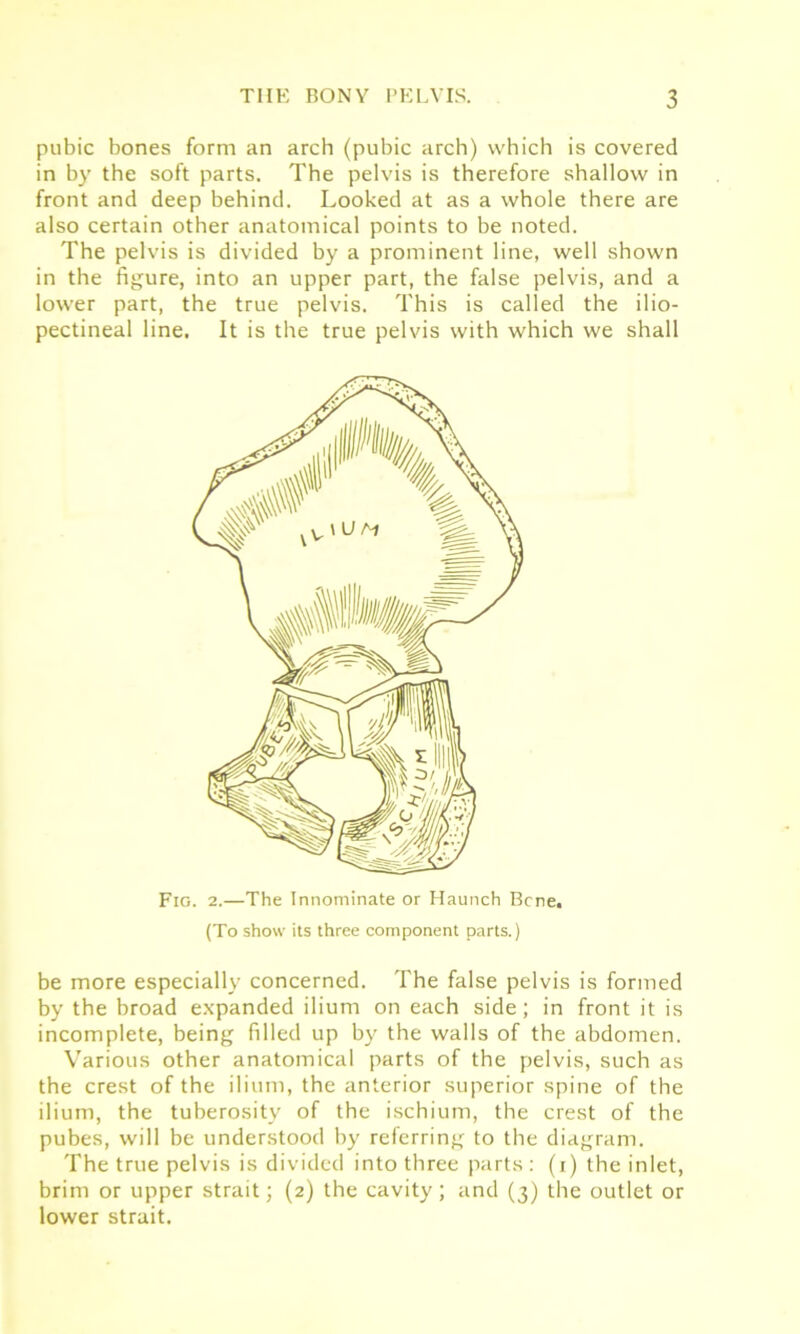 pubic bones form an arch (pubic arch) which is covered in by the soft parts. The pelvis is therefore shallow in front and deep behind. Looked at as a whole there are also certain other anatomical points to be noted. The pelvis is divided by a prominent line, well shown in the figure, into an upper part, the false pelvis, and a lower part, the true pelvis. This is called the ilio- pectineal line. It is the true pelvis with which we shall Fig. 2.—The Innominate or Haunch Bene. (To show its three component parts.) be more especially concerned. The false pelvis is formed by the broad expanded ilium on each side; in front it is incomplete, being filled up by the walls of the abdomen. Various other anatomical parts of the pelvis, such as the crest of the ilium, the anterior superior spine of the ilium, the tuberosity of the ischium, the crest of the pubes, will be understood by referring to the diagram. The true pelvis is divided into three parts : (i) the inlet, brim or upper strait; (2) the cavity; and (3) the outlet or lower strait.