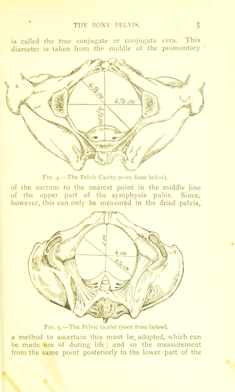 is called the true conjugate or conjugata vera. This diameter is taken from the middle of the promontory Fig. i.—The Pelvic Cavity (seen from below) xJ f \ V 4-/2 /At 1 ■is A V \\ IJ \ Jr V// of the sacrum to the nearest point in the middle line of the upper part of the symphysis pubis. Since, however, this can only be measured in the dried pelvis, Fig. 5.—The Pelvic Outlet (seen from below). a method to ascertain this must be. adopted, which can be made use of during life; and so the measurement from the same point posteriorly to the lower part of the
