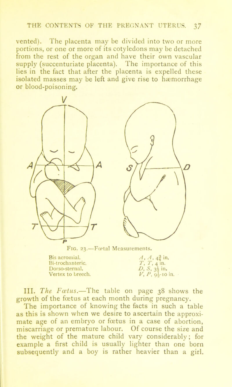 vented). The placenta may be divided into two or more portions, or one or more of its cotyledons may be detached from the rest of the organ and have their own vascular supply (succenturiate placenta). The importance of this lies in the fact that after the placenta is expelled these isolated masses may be left and give rise to hemorrhage or blood-poisoning. 1/ Bis acromial. Bi-trochanteric. Dorso-sternal. Vertex to breech. Measurements. A, A, 4^ in. T, T, 4 in. D, S, 3i in. V, P, 95-10 in. III. The Foetus.—The table on page 38 shows the growth of the foetus at each month during pregnancy. The importance of knowing the facts in such a table as this is shown when we desire to ascertain the approxi- mate age of an embryo or foetus in a case of abortion, miscarriage or premature labour. Of course the size and the weight of the mature child vary considerably; for example a first child is usually lighter than one born subsequently and a boy is rather heavier than a girl.
