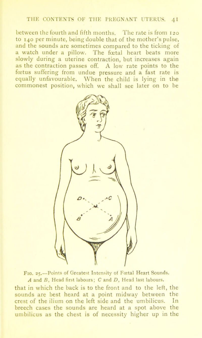 between the fourth and fifth months. The rate is from 120 to 140 per minute, being double that of the mother’s pulse, and the sounds are sometimes compared to the ticking of a watch under a pillow. The foetal heart beats more slowly during a uterine contraction, but increases again as the contraction passes off. A low rate points to the foetus suffering from undue pressure and a fast rate is equally unfavourable. When the child is lying in the commonest position, which we shall see later on to be Fig. 25.—Points of Greatest Intensity of Fcetal Heart Sounds. A and B, Head first labours; C and D, Head last labours, that in which the back is to the front and to the left, the sounds are best heard at a point midway between the crest of the ilium on the left side and the umbilicus. In breech cases the sounds are heard at a spot above the umbilicus as the chest is of necessity higher up in the