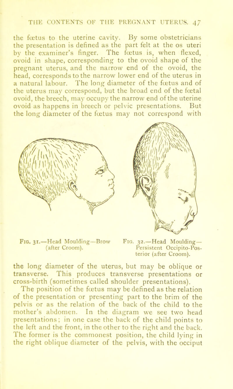 the foetus to the uterine cavity. By some obstetricians the presentation is defined as the part felt at the os uteri by the examiner’s finger. The foetus is, when flexed, ovoid in shape, corresponding to the ovoid shape of the pregnant uterus, and the narrow end of the ovoid, the head, corresponds to the narrow lower end of the uterus in a natural labour. The long diameter of the foetus and of the uterus may correspond, but the broad end of the foetal ovoid, the breech, maj' occupy the narrow end of the uterine ovoid as happens in breech or pelvic presentations. But the long diameter of the foetus may not correspond with Fig. 31.—Head Moulding—Brow Fig. 32.—Head Moulding— (after Croom). Persistent Occipito-Pos- terior (after Croom). the long diameter of the uterus, but may be oblique or transverse. This produces transverse presentations or cross-birth (sometimes called shoulder presentations). The position of the foetus may be defined as the relation of the presentation or presenting part to the brim of the pelvis or as the relation of the back of the child to the mother’s abdomen. In the diagram we see two head presentations; in one case the back of the child points to the left and the front, in the other to the right and the back. The former is the commonest position, the child lying in the right oblique diameter of the pelvis, with the occiput