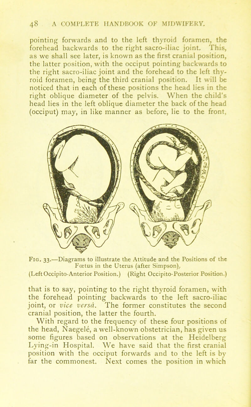 pointing forwards and to the left thyroid foramen, the forehead backwards to the right sacro-iliac joint. This, as we shall see later, is known as the first cranial position, the latter position, with the occiput pointing backwards to the right sacro-iliac joint and the forehead to the left thy- roid foramen, being the third cranial position. It will be noticed that in each of these positions the head lies in the right oblique diameter of the pelvis. When the child’s head lies in the left oblique diameter the back of the head (occiput) may, in like manner as before, lie to the front, Fig. 33.—Diagrams to illustrate the Attitude and the Positions of the Fcetus in the Uterus (after Simpson).. (Left Occipito-Anterior Position.) (Right Occipito-Posterior Position.) that is to say, pointing to the right thyroid foramen, with the forehead pointing backwards to the left sacro-iliac joint, or vice versa. The former constitutes the second cranial position, the latter the fourth. With regard to the frequency of these four positions of the head, Naegele, a well-known obstetrician, has given us some figures based on observations at the Heidelberg Lying-in Hospital. We have said that the first cranial position with the occiput forwards and to the left is by far the commonest. Next comes the position in which