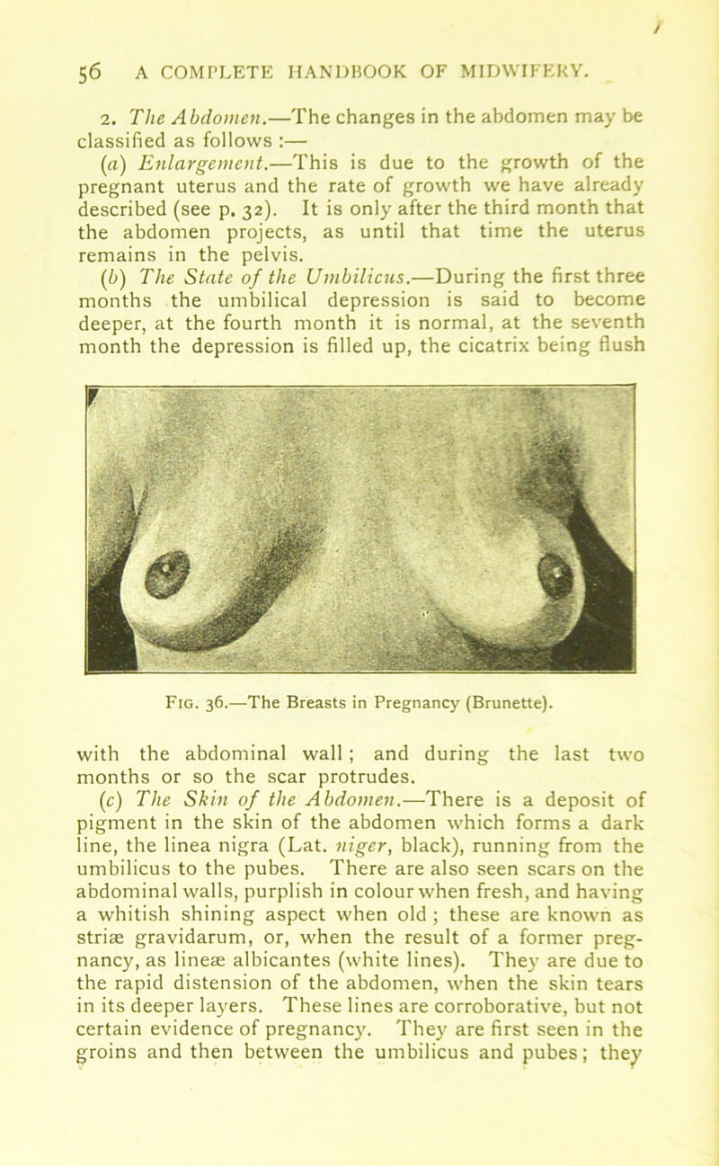 / 56 A COMPLETE HANDBOOK OF MIDWIFERY. 2. The Abdomen.—The changes in the abdomen may be classified as follows :— (a) Enlargement.—This is due to the growth of the pregnant uterus and the rate of growth we have already described (see p. 32). It is only after the third month that the abdomen projects, as until that time the uterus remains in the pelvis. (b) The State of the Umbilicus.—During the first three months the umbilical depression is said to become deeper, at the fourth month it is normal, at the seventh month the depression is filled up, the cicatrix being flush Fig. 36.—The Breasts in Pregnancy (Brunette). with the abdominal wall; and during the last two months or so the scar protrudes. (c) The Skin of the Abdomen.—There is a deposit of pigment in the skin of the abdomen which forms a dark line, the linea nigra (Lat. niger, black), running from the umbilicus to the pubes. There are also seen scars on the abdominal walls, purplish in colour when fresh, and having a whitish shining aspect when old ; these are known as striae gravidarum, or, when the result of a former preg- nancy, as lineae albicantes (white lines). They are due to the rapid distension of the abdomen, when the skin tears in its deeper layers. These lines are corroborative, but not certain evidence of pregnancy. They are first seen in the groins and then between the umbilicus and pubes; they