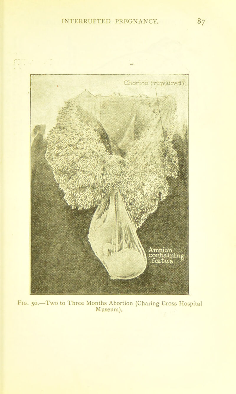 Fig. 50.—Two to Three Months Abortion (Charing Cross Hospital Museum),