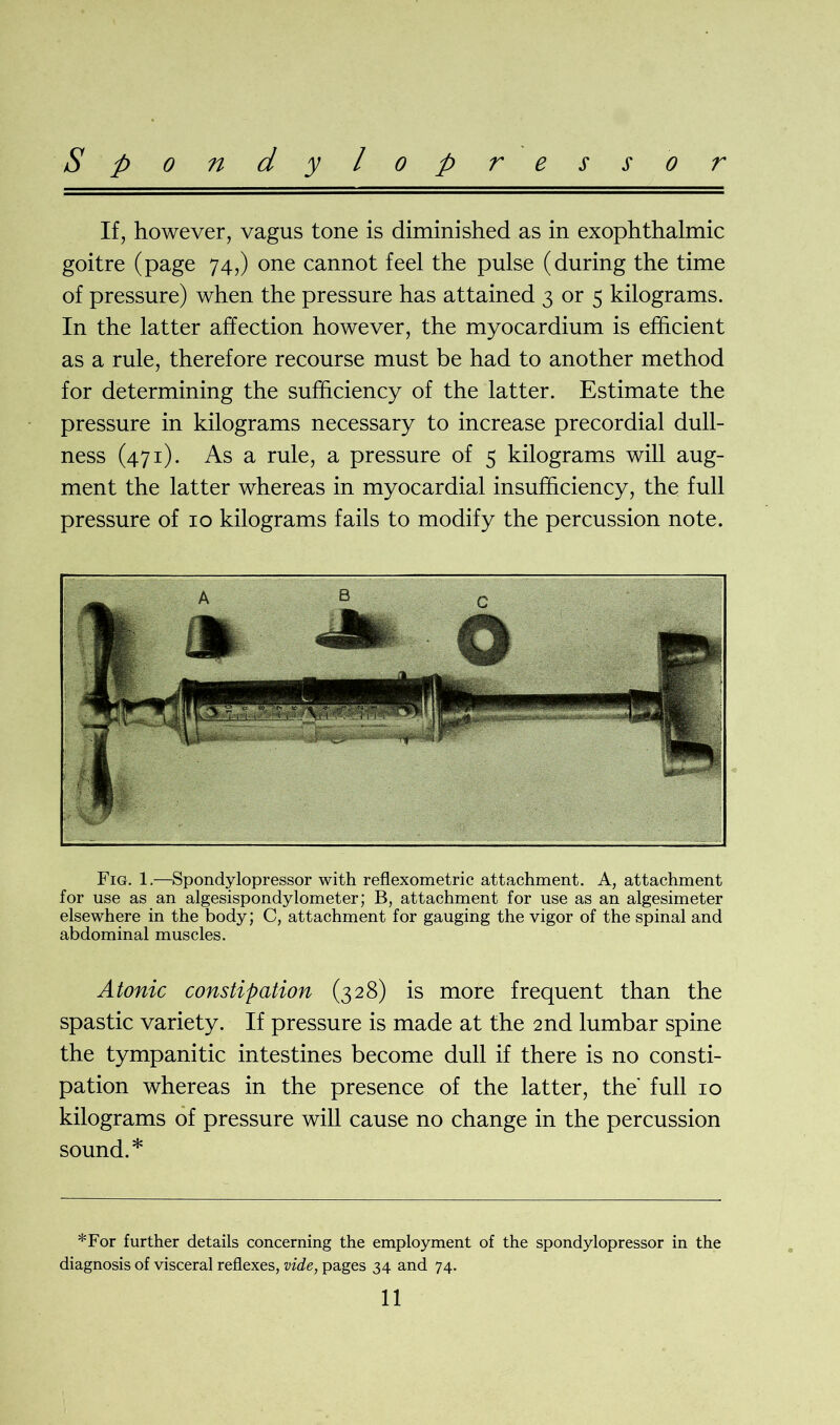 If, however, vagus tone is diminished as in exophthalmic goitre (page 74,) one cannot feel the pulse (during the time of pressure) when the pressure has attained 3 or 5 kilograms. In the latter affection however, the myocardium is efficient as a rule, therefore recourse must be had to another method for determining the sufficiency of the latter. Estimate the pressure in kilograms necessary to increase precordial dull- ness (471). As a rule, a pressure of 5 kilograms will aug- ment the latter whereas in myocardial insufficiency, the full pressure of 10 kilograms fails to modify the percussion note. Fig. 1.—Spondylopressor with reflexometric attachment. A, attachment for use as an algesispondylometer; B, attachment for use as an algesimeter elsewhere in the body; C, attachment for gauging the vigor of the spinal and abdominal muscles. Atonic constipation (328) is more frequent than the spastic variety. If pressure is made at the 2nd lumbar spine the tympanitic intestines become dull if there is no consti- pation whereas in the presence of the latter, the full 10 kilograms of pressure will cause no change in the percussion sound.* *For further details concerning the employment of the spondylopressor in the diagnosis of visceral reflexes, vide, pages 34 and 74.