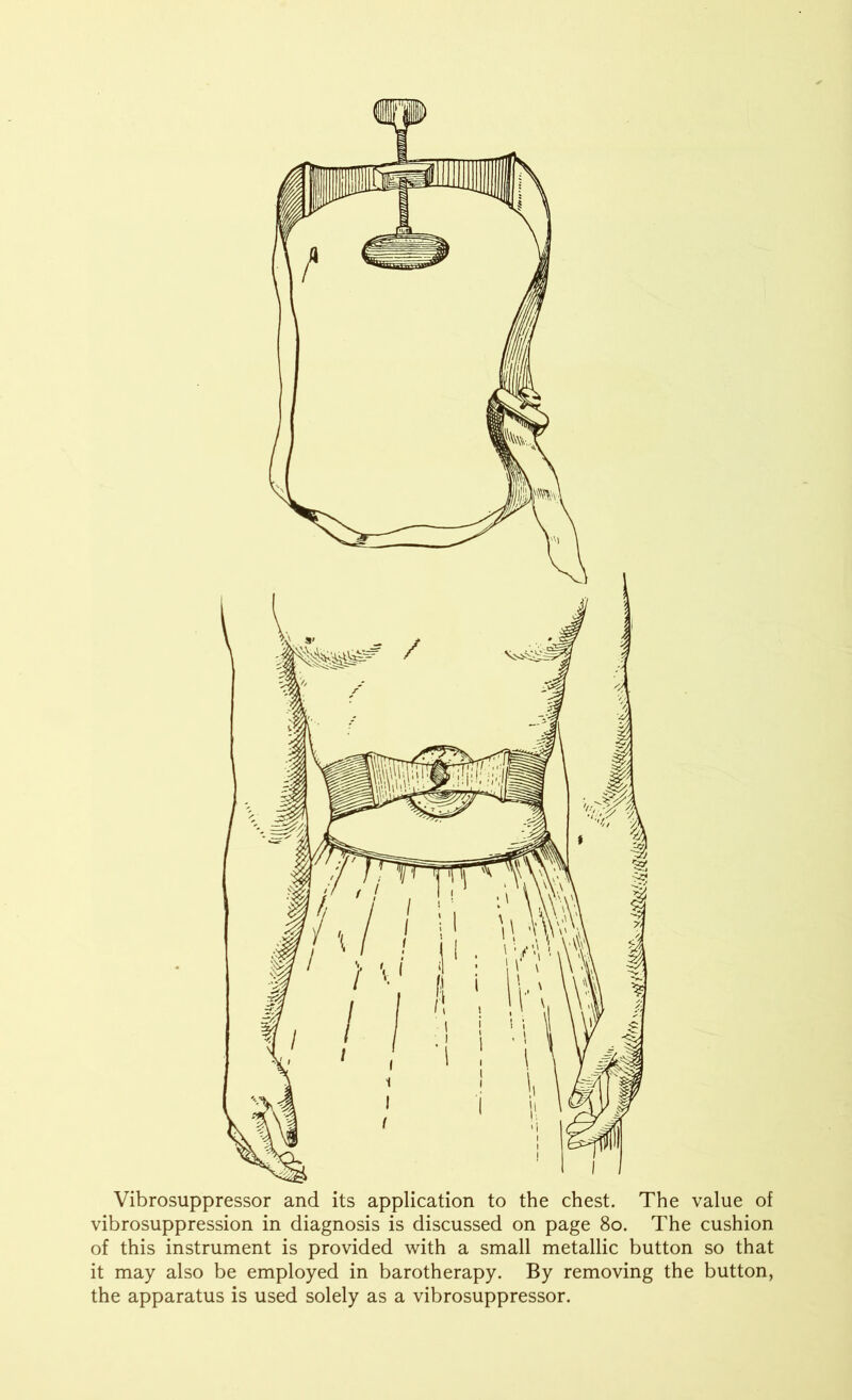 Vibrosuppressor and its application to the chest. The value of vibrosuppression in diagnosis is discussed on page 80. The cushion of this instrument is provided with a small metallic button so that it may also be employed in barotherapy. By removing the button, the apparatus is used solely as a vibrosuppressor.
