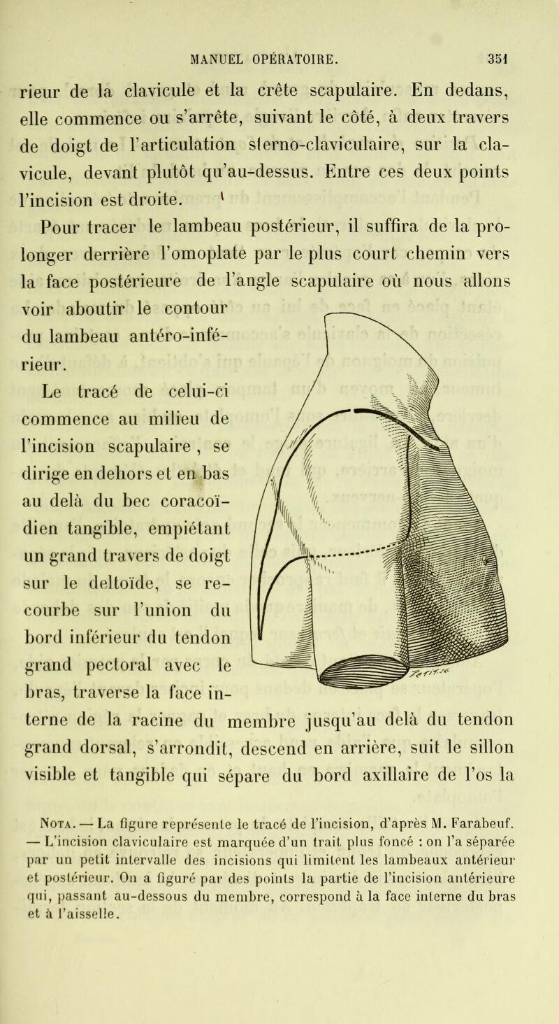 rieur de la clavicule et la crête scapulaire. En dedans, elle commence ou s’arrête, suivant le côté, à deux travers de doigt de l’articulation sterno-claviculaire, sur la cla- vicule, devant plutôt qu’au-dessus. Entre ces deux points l’incision est droite. ' Pour tracer le lambeau postérieur, il suffira de la pro- longer derrière l’omoplate par le plus court chemin vers la face postérieure de l’angle scapulaire ou nous allons voir aboutir le contour du lambeau antéro-infé- rieur. Le tracé de celui-ci commence au milieu de l’incision scapulaire, se dirige en dehors et en bas au delà du bec coracoï- dien tangible, empiétant un grand travers de doigt sur le deltoïde, se re- courbe sur l’union du bord inférieur du tendon grand pectoral avec le liras, traverse la face in- terne de la racine du membre jusqu’au delà du tendon grand dorsal, s’arrondit, descend en arrière, suit le sillon visible et tangible qui sépare du bord axillaire de l’os la Nota. — La figure représente le tracé de l’incision, d’après M. Farabeuf. — L’incision claviculaire est marquée d’un trait plus foncé : on l’a séparée par un petit intervalle des incisions qui limitent les lambeaux antérieur et postérieur. On a figuré par des points la partie de l’incision antérieure qui, passant au-dessous du membre, correspond à la face interne du bras et à l’aisselle.