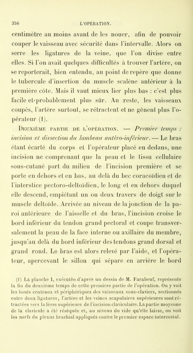 centimètre au moins avant de les nouer, afin de pouvoir couper le vaisseau avec sécurité dans l’intervalle. Alors on serre les ligatures de la veine, que l’on divise entre elles,. Si l’on avait quelques difficultés à trouver l’artère, on se reporterait, bien entendu, au point de repère que donne le tubercule d’insertion du muscle scalène antérieur à la première côte. Mais il vaut mieux lier plus bas : c’est plus facile et'probablement plus sûr. Au reste, les vaisseaux coupés, l’artère surtout, se rétractent et ne gênent plus l’o- pérateur (1). Deuxième partie de l’opération. — Premier temps : incision et dissection du lambeau antéro-inférieur. — Le bras étant écarté du corps et l’opérateur placé en dedans, une incision ne comprenant que la peau et le tissu cellulaire sous-cutané part du milieu de l’incision première et se porte en dehors et en bas, au delà du bec coracoïdien et de l'interstice pectoro-deltoïdien, le long et en dehors duquel elle descend, empiétant un ou deux travers de doigt sur le muscle deltoïde. Arrivée au niveau de la jonction de la pa- roi antérieure de l’aisselle et du bras, l’incision croise le bord inférieur du tendon grand pectoral et coupe transver- salement la peau de la face interne ou axillaire du membre, jusqu’au delà du bord inférieur des tendons grand dorsal et grand rond. Le bras est alors relevé par l’aide, et l’opéra- teur, apercevant le sillon qui sépare en arrière le bord (i) La planche I, exécutée, d’après un dessin de M. Farabeuf, représente la fin du deuxième temps de cette première partie de l’opération. On y voit les bouts centraux et périphériques des vaisseaux sous-claviers, sectionnés entre deux ligatures, l’artère et les veines scapulaires supérieures sont ré- tractées vers la lèvre supérieure de l’incision claviculaire. La partie moyenne de la clavicule a été réséquée et, au niveau du vide qu’elle laisse, on voit les nerfs du plexus brachial appliqués contre le premier espace intercostal.