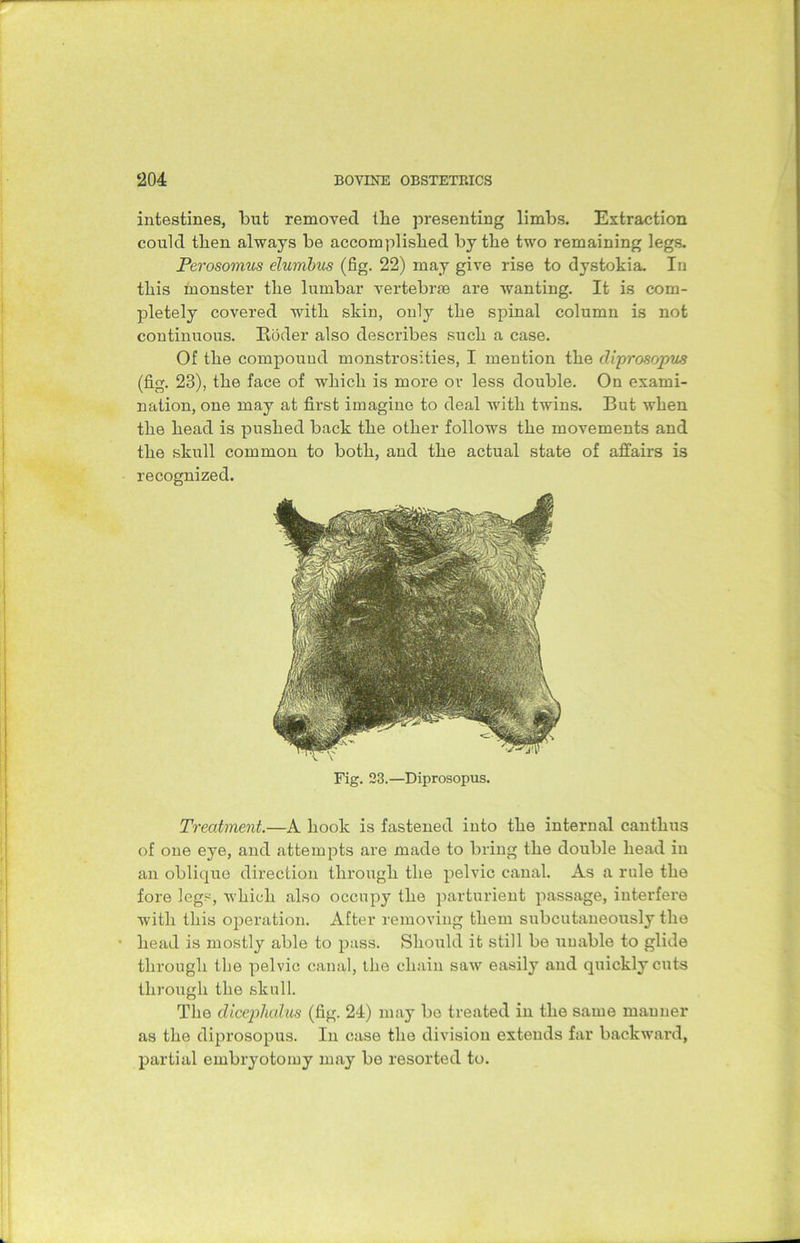 intestines, but removed the presenting limbs. Extraction could then always be accomplished by the two remaining legs. Perosomus elumbus (fig. 22) may give rise to dystokia. In this monster tlie lumbar vertebrae are wanting. It is com- pletely covered with skin, only tlie spinal column is not continuous. Ptoder also describes sucli a case. Of the compound monstrosities, I mention the diprosopus (fig. 23), the face of which is more or less double. On exami- nation, one may at first imagine to deal with twins. But when the head is pushed back the other follows the movements and the skull common to both, and the actual state of affairs is recognized. Fig. 23.—Diprosopus. Treatment.—A hook is fastened into the internal canthus of one eye, and attempts are made to bring the double head in an oblique direction through the pelvic canal. As a rule the fore legs, which also occupy the parturient passage, interfere with this operation. After removing them subcutaneously the head is mostly able to pass. Should it still be unable to glide through the pelvic canal, the chain saw easily and quickly cuts through the skull. The dicephalus (fig. 24) may bo treated in the same manner as the diprosopus. In case the division extends far backward, partial embryotomy may be resorted to.
