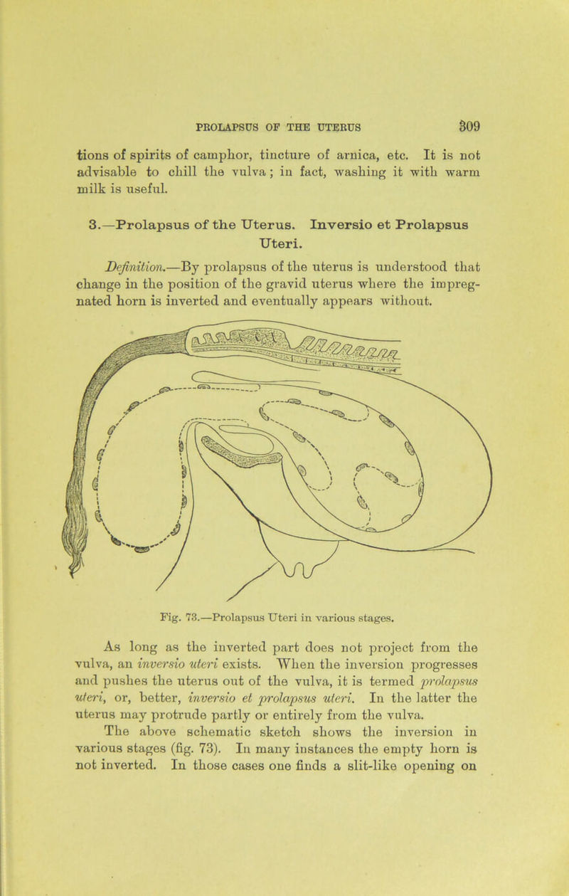 tions of spirits of camphor, tincture of arnica, etc. It is not advisable to chill the vulva ; in fact, washing it with warm milk is useful. 3.—Prolapsus of the Uterus. Inversio et Prolapsus Uteri. Definition.—By prolapsus of the uterus is understood that change in the position of the gravid uterus where the impreg- nated horn is inverted and eventually appears without. As long as the inverted part does not project from the vulva, an inversio uteri exists. When the inversion progresses and pushes the uterus out of the vulva, it is termed prolapsus uteri, or, better, inversio et prolapsus uteri. In the latter the uterus may protrude partly or entirely from the vulva. The above schematic sketch shows the inversion in various stages (fig. 73). In many instances the empty horn is not inverted. In those cases one finds a slit-like opening on