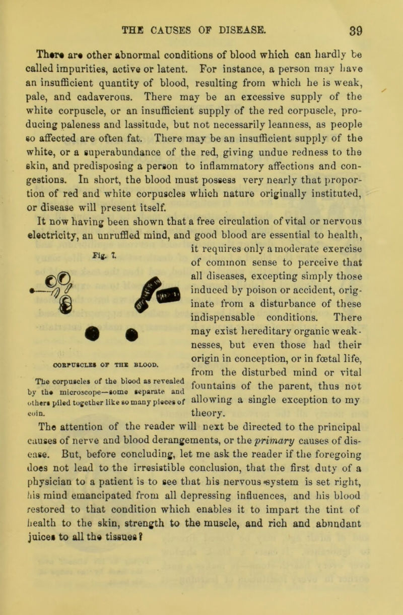 Fig. 7. There are other abnormal conditions of blood which can hardly be called impurities, active or latent. For instance, a person may have an insufficient quantity of blood, resulting from which he is weak, pale, and cadaverous. There may be an excessive supply of the white corpuscle, or an insufficient supply of the red corpuscle, pro- ducing paleness and lassitude, but not necessarily leanness, as people so affected are often fat. There may be an insufficient supply of the white, or a superabundance of the red, giving undue redness to the skin, and predisposing a person to inflammatory affections and con- gestions. In short, the blood must possess very nearly that propor- tion of red and white corpuscles which nature originally instituted, or disease will present itself. It now having been shown that a free circulation of vital or nervous electricity, an unruffled mind, and good blood are essential to health, it requires only a moderate exercise of common sense to perceive that m a all diseases, excepting simply those ~ ° — induced by poison or accident, orig- inate from a disturbance of these indispensable conditions. There may exist hereditary organic weak- nesses, but even those had their origin in conception, or in foetal life, from the disturbed mind or vital Tlie corpuscles of the blood as revealed fountaing of the fc thus not by th* microscope—some separate and # _ r other* piled together like so many piece* of allowing a single exception to my coin. theory. The attention of the reader will next be directed to the principal causes of nerve and blood derangements, or the primary causes of dis- ease. But, before concluding, let me ask the reader if the foregoing does not lead to the irresistible conclusion, that the first duty of a physician to a patient is to see that his nervous <eystem is set right, his mind emancipated from all depressing influences, and his blood restored to that condition which enables it to impart the tint of health to the skin, strength to the muscle, and rich and abundant juicea to all the tissues? CORPUSCLE* OF THE BLOOD.