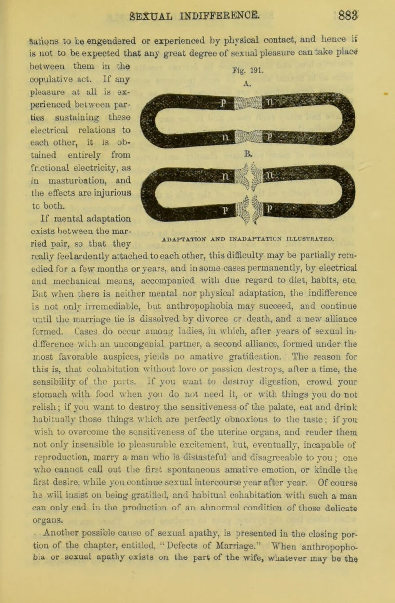 sations to be engendered or experienced by physical contact, and hence it is not to be expected that any great degree of sexual pleasure can take place between them in the copulative act. If any pleasure at all is ex- perienced between par- ties sustaining these electrical relations to each other, it is ob- tained entirely from frictional electricity, as in masturbation, and the effects are injurious to both. If mental adaptation exists between the mar- ried pair, so that they really feelardently attached to each other, this difficulty may be partially rem- edied for a few months or years, and in some cases permanently, by electrical and mechanical means, accompanied with due regard to diet, habits, etc. Cut when there is neither mental nor physical adaptation, the indifference is not only irremediable, but anthropophobia may succeed, and continue until the marriage tie is dissolved by divorce or death, and a new alliance formed. Cases do occur among ladies, in which, after years of sexual in- difference with an uncongenial partner, a second alliance, formed under the most favorable auspices, yields no amative gratification. The reason for this is, that cohabitation without love or passion destroys, after a tune, the sensibility of the parts. If you want to destroy digestion, crowd your stomach with food when you do not need it, or with things you do not relish; if you want to destroy the sensitiveness of the palate, eat and drink habitually those things which are perfectly obnoxious to the taste; if you wish to overcome the sensitiveness of the uterine organs, and render them not only insensible to pleasurable excitement, but, eventually, incapable of reproduction, marry a man who is distasteful and disagreeable to you ; one who cannot call out the first spontaneous amative emotion, or kindle the first desire, while you continue sexual intercourse year after year. Of course he will iusist on being gratified, and habitual cohabitation with such a man can only end in the production of an abnormal condition of those delicate organs. Another possible cause of sexual apathy, is presented in the closing por- tion of the chapter, entitled, “Defects of Marriage.” When anthropopho- bia or sexual apathy exists on the part of the wife, whatever may be the ADAPTATION AND INADAPTATION ILLUSTRATED.