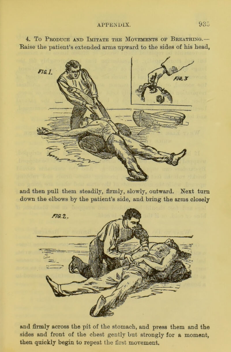 4. To Produce and Imitate the Movements of Breathing.— Raise the patient’s extended arms upward to the sides of his head, and then pull them steadily, firmly, slowly, outward. Next turn down the elbows by the patient’s side, and bring the arras closely and firmly across the pit of the stomach, and press them and the sides and front of the chest gently but strongly for a moment, then quickly begin to repeat the first movement.