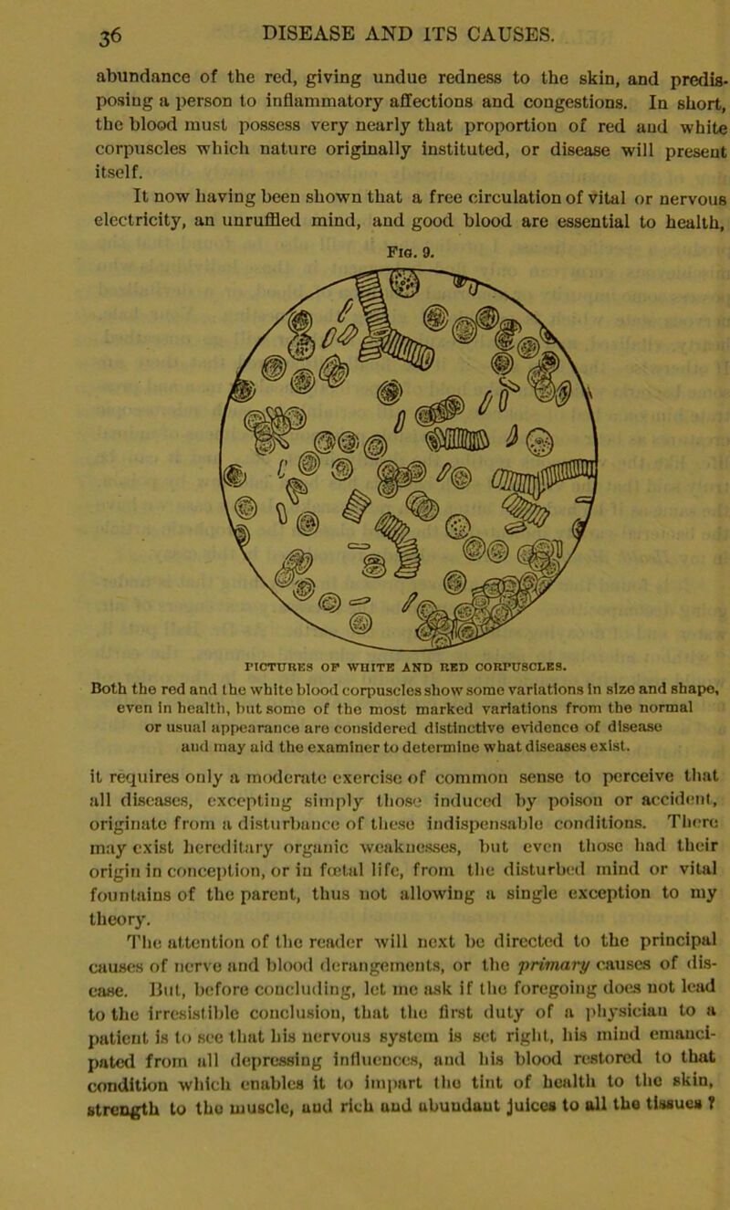 abundance of the red, giving undue redness to the skin, and predis- posing a person to inflammatory affections and congestions. In short, the blood must possess very nearly that proportion of red and white corpuscles which nature originally instituted, or disease will present itself. It now having been shown that a free circulation of vital or nervous electricity, an unruffled mind, and good blood are essential to health, Fro. 9. PICTURES OP WHITE AND RED CORPUSCLES. Both the red and Ihe white blood corpuscles show some variations In size and shape, even in health, but somo of the most marked variations from the normal or usual appearance are considered distinctive evidence of disease and may aid the examiner to determine what diseases exist. it requires only a moderate exercise of common sense to perceive that all diseases, excepting simply those induced by poison or accident, originate from a disturbance of these indispensable conditions. There may exist hereditary organic weaknesses, but even those had their origin in conception, or in foetal life, from the disturbed mind or vital fountains of the parent, thus not allowing a single exception to my theory. The attention of the reader will next be directed to the principal causes of nerve and blood derangements, or the 'primary causes of dis- ease. But, before concluding, let me ask if the foregoing does not lead to the irresistible conclusion, that the first duty of a physician to a patient is to see that his nervous system is set right, his mind emanci- pated from all depressing influences, and his blood restored to that condition which enables it to impart tho tint of health to the skin, strength to tho muscle, uud rich and ubuudaut juices to all the tissues ?