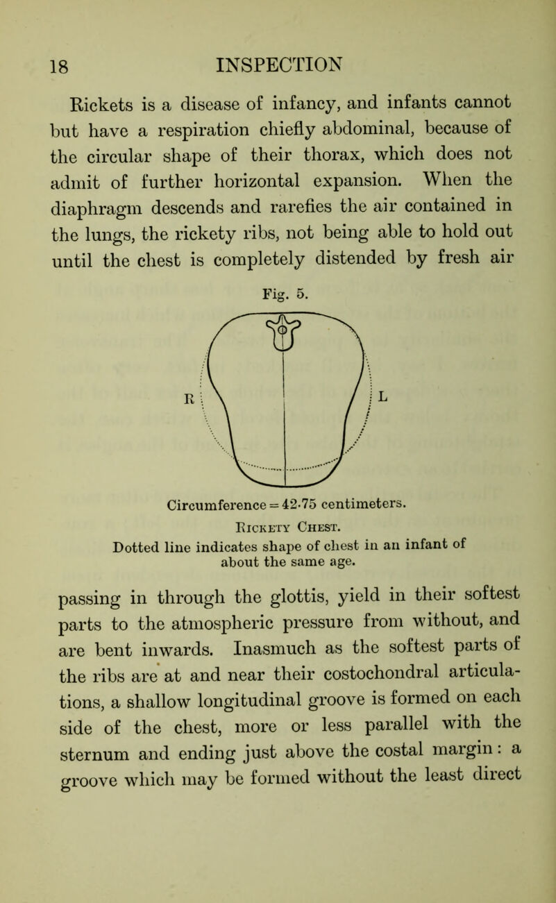 Rickets is a disease of infancy, and infants cannot but have a respiration chiefly abdominal, because of the circular shape of their thorax, which does not admit of further horizontal expansion. When the diaphragm descends and rarefies the air contained in the lungs, the rickety ribs, not being able to hold out until the chest is completely distended by fresh air Fig. 5. Circumference = 42*75 centimeters. Rickety Chest. Dotted line indicates shape of chest in an infant of about the same age. passing in through the glottis, yield in their softest parts to the atmospheric pressure from without, and are bent inwards. Inasmuch as the softest parts of the ribs are at and near their costochondral articula- tions, a shallow longitudinal groove is formed on each side of the chest, more or less parallel with the sternum and ending just above the costal margin: a groove which may be formed without the least direct