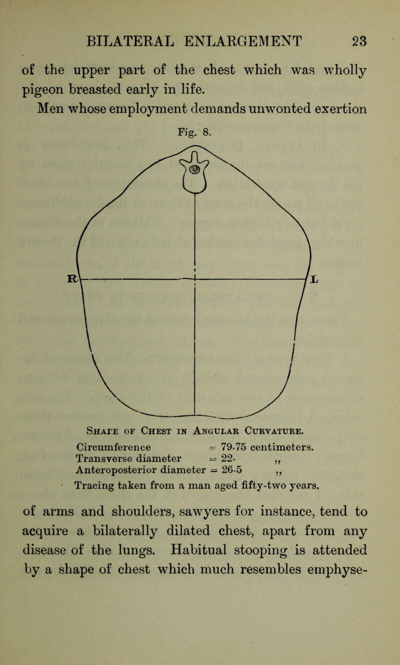 of the upper part of the chest which was wholly pigeon breasted early in life. Men whose employment demands unwonted exertion Fig. 8. Circumference = 79*75 centimeters. Transverse diameter — 22. „ Anteroposterior diameter = 26-5 ,, Tracing taken from a man aged fifty-two years. of arms and shoulders, sawyers for instance, tend to acquire a bilaterally dilated chest, apart from any disease of the lungs. Habitual stooping is attended by a shape of chest which much resembles emphyse-