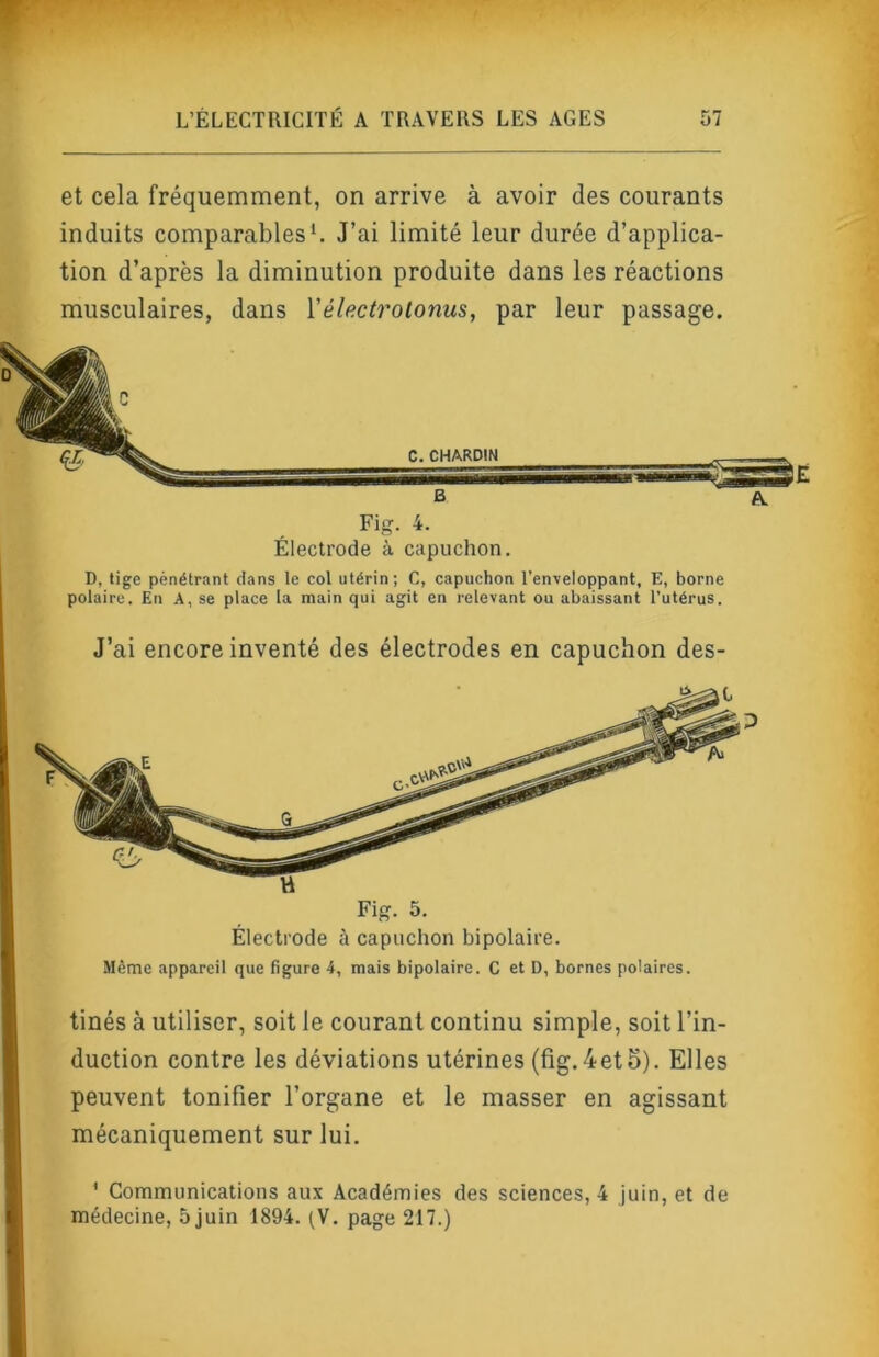 et cela fréquemment, on arrive à avoir des courants induits comparables L J’ai limité leur durée d’applica- tion d’après la diminution produite dans les réactions musculaires, dans Vélectrolonus, par leur passage. Fig. 4. Électrode à capuchon. D, tige pénétrant dans le col utérin; C, capuchon l’enveloppant, E, borne polaire. En A, se place la main qui agit en relevant ou abaissant l’utérus. J’ai encore inventé des électrodes en capuchon des- Fig. 5. Électrode à capuchon bipolaire. Même appareil que figure 4, mais bipolaire. C et D, bornes polaires. tinés à utiliser, soit le courant continu simple, soit l’in- duction contre les déviations utérines (fig.4et5). Elles peuvent tonifier l’organe et le masser en agissant mécaniquement sur lui. ' Communications aux Académies des sciences, 4 juin, et de médecine, 5 juin 1894. (V. page 217.)