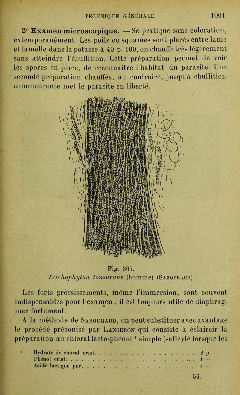 2° Examen microscopique. —Se pratique sans coloration, extemporanément. Les poils ou squames sont placés entre lame et lamelle dans la potasse à 40 p. 100, on chauffe très légèrement sans atteindre l’ébullition. Cette préparation permet de voir les spores en place, de reconnaître l'habitat du parasite. Une seconde préparation chauffée, au contraire, jusqu’à ébullition commençante met le parasite en liberté. Fig. 365. Trichophyton tonsurans (homme) (Sabouraüd). Les forts grossissements, même l’immersion, sont souvent Indispensables pour l’examen ; il est toujours utile de diaphrag- mer fortement. A la méthode de Sabouraud, on peut substituer avec avantage le procédé préconisé par Langeron qui, consiste à éclaircir la préparation au chloral lacto-phénol1 simple (salicylé lorsque les Hydrate de choral crist 2 p. Phénol crist. 1 — Acide lactique pur 1 — 56.