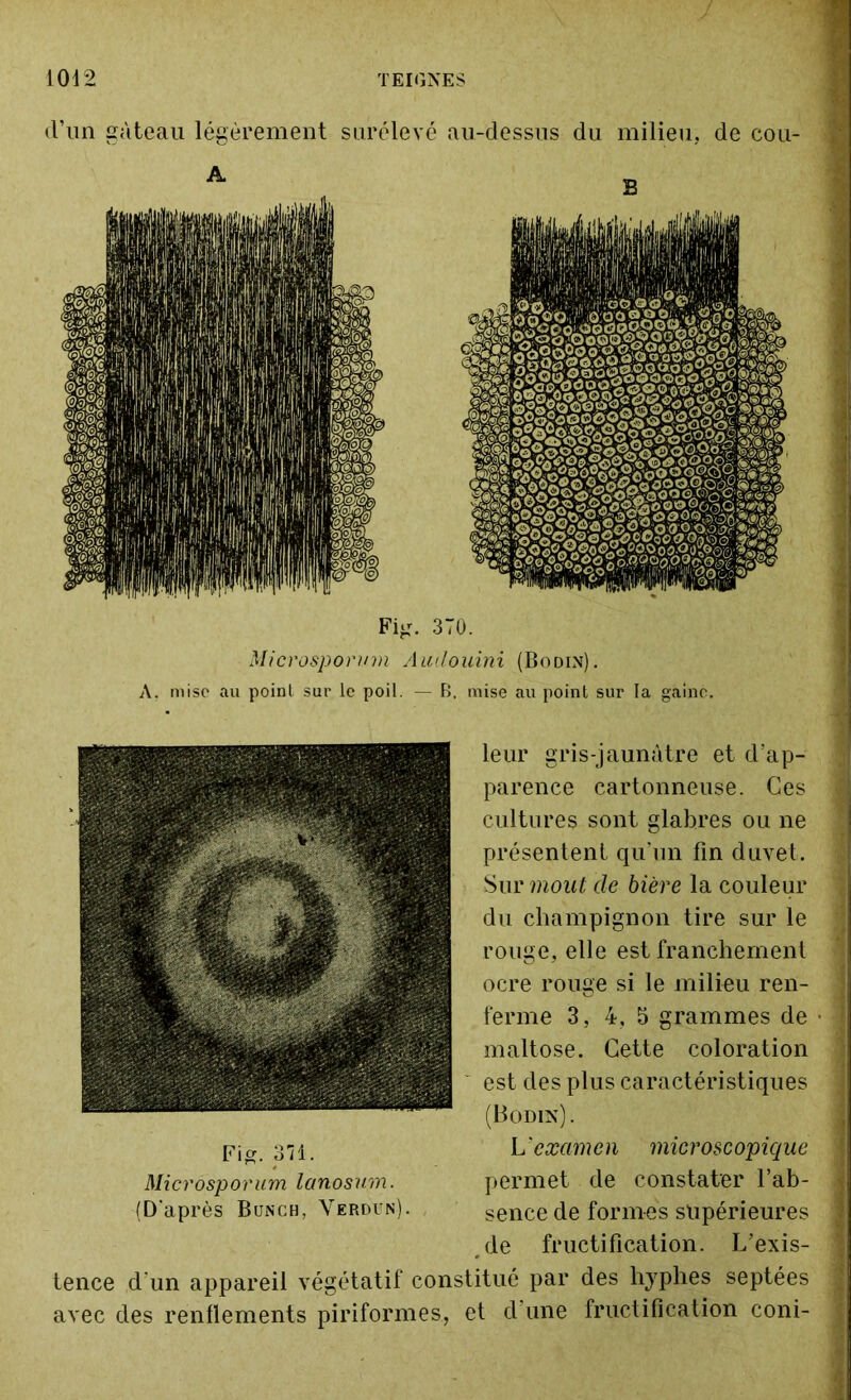 d’un gâteau légèrement surélevé au-dessus du milieu, de cou- Fig. 370. Microsporum Autlouini (Bodin). A. mise au point sur le poil. — B. mise au point sur la gaine. leur gris-jaunâtre et d’ap- parence cartonneuse. Ces cultures sont glabres ou ne présentent qu’un fin duvet. Sur moût de bière la couleur du champignon tire sur le rouge, elle est franchement ocre rouge si le milieu ren- ferme 3, 4, 5 grammes de maltose. Cette coloration est des plus caractéristiques (Bodin). Fja 37i. L'examen microscopique Microsporum lanosum. permet de constater l’ab- (D'après Bunch, Verdun). sence de formes supérieures .de fructification. L’exis- tence d'un appareil végétatif constitué par des hyphes septées avec des renflements piriformes, et d’une fructification coni-