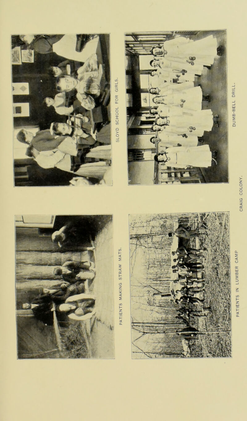 PATIENTS IN LUMBER CAMP