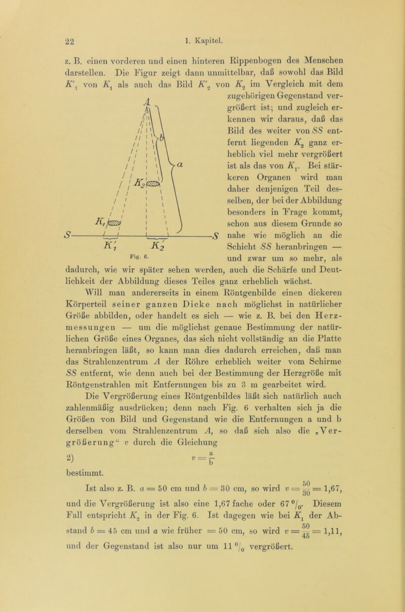 K\ von K, als auch das Bild K' z. B. einen vorderen und einen hinteren Rippenbogen des Menschen darstellen. Die Figur zeigt dann unmittelbar, daß sowohl das Bild von im Vergleich mit dem zugehörigen Gegenstand ver- größert ist; und zugleich er- kennen wir daraus, daß das Bild des weiter von SS ent- fernt liegenden ganz er- heblich viel mehr vergrößert ist als das von K^. Bei stär- keren Organen wird man daher denjenigen Teil des- selben, der bei der Abbildung besonders in Frage kommt, schon aus diesem Grunde so nahe wie möglich an die Schicht aSS heranbringen — und zwar um so mehr, als dadurch, wie wir später sehen werden, auch die Schärfe und Deut- lichkeit der Abbildung dieses Teiles ganz erheblich wächst. AVill man andererseits in einem Röntgenbilde einen dickeren Körperteil seiner ganzen Dicke nach möglichst in natürlicher Größe abbilden, oder handelt es sich — wie z. B. bei den Herz- messungen — um die möglichst genaue Bestimmung der natür- lichen Größe eines Organes, das sich nicht vollständig an die Platte heranbringen läßt, so kann man dies dadurch erreichen, daß man das Strahlenzentrum A der Röhre erheblich weiter vom Schirme aSS entfernt, wie denn auch bei der Bestimmung der Herzgröße mit Röntgenstrahlen mit Entfernungen bis zu 3 m gearbeitet wird. Die Vergrößerung eines Röntgenbildes läßt sich natürlich auch zahlenmäßig ausdrücken; denn nach Fig. 6 verhalten sich ja die Größen von Bild und Gegenstand wie die Entfernungen a und b derselben vom Strahlenzentrum A, so daß sich also die „Ver- Fig. 6. größerung“ V durch die Gleichung a b 50 2) bestimmt. Ist also z. B. a = 50 cm und ^ = 30 cm, so wird v = = 1,67, und die Vergrößerung ist also eine 1,67 fache oder 67®/^. Diesem Fall entspricht in der Fig. 6. Ist dagegen wie bei der Ab- 50 stand 6 = 45 cm und a wie früher = 50 cm, so wird v = -^ = 1,11, ; 45 ; j und der Gegenstand ist also nur um ll®/o vergrößert.