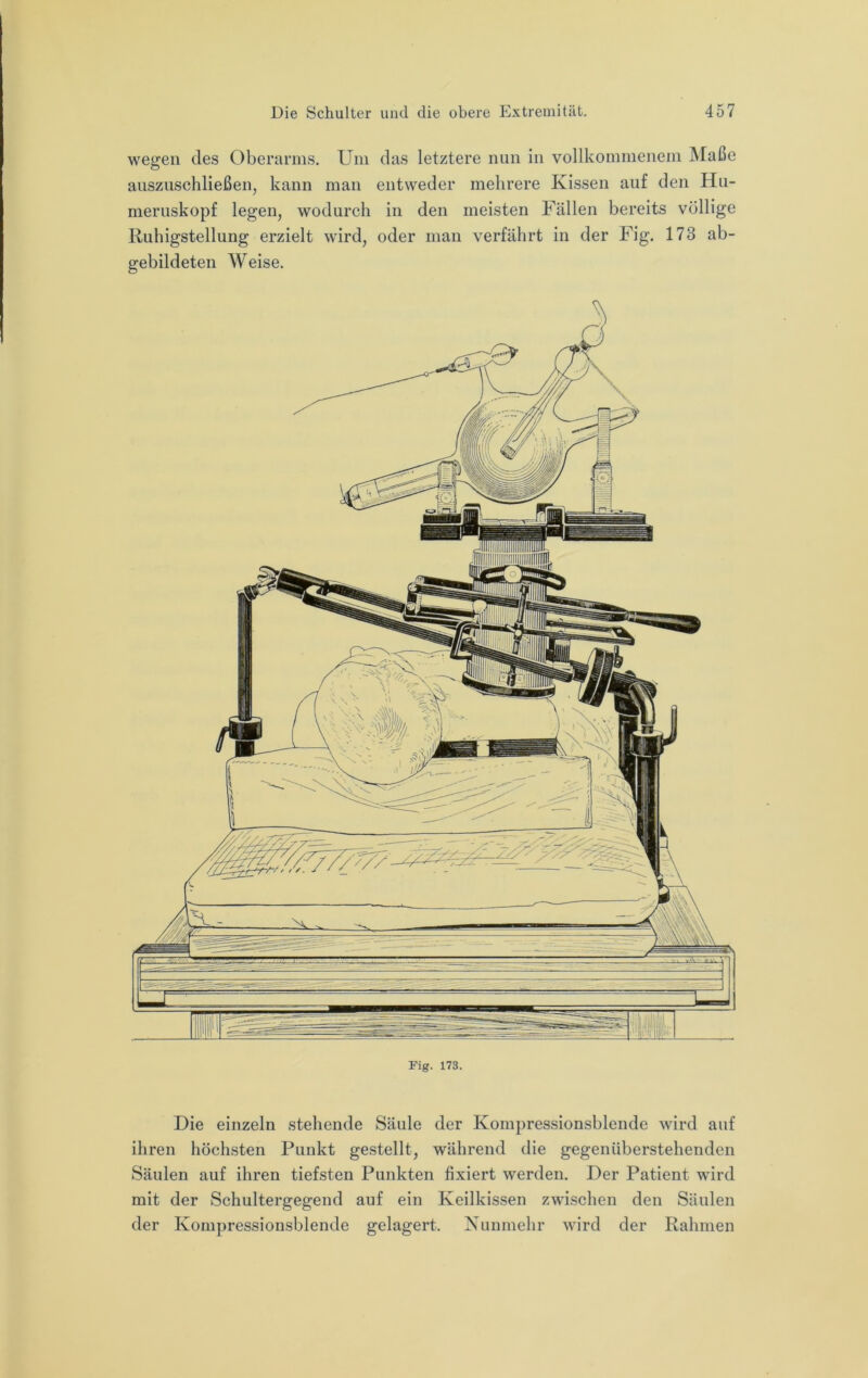 wegen des Oberarms. Um das letztere nun in vollkommenem Maße auszuschließen, kann man entweder mehrere Kissen auf den Hu- meruskopf legen, wodurch in den meisten Fällen bereits völlige Ruhigstellung erzielt wird, oder man verfährt in der Fig. 173 ab- gebildeten Weise. HiillinifF jB lii ll Fig. 173. Die einzeln stehende Säule der Kompressionsblende wird auf ihren höchsten Punkt gestellt, während die gegenüberstehenden Säulen auf ihren tiefsten Punkten fixiert werden. Der Patient wird mit der Schultergegend auf ein Keilkissen zwischen den Säulen der Kompressionsblende gelagert. Nunmehr wird der Rahmen