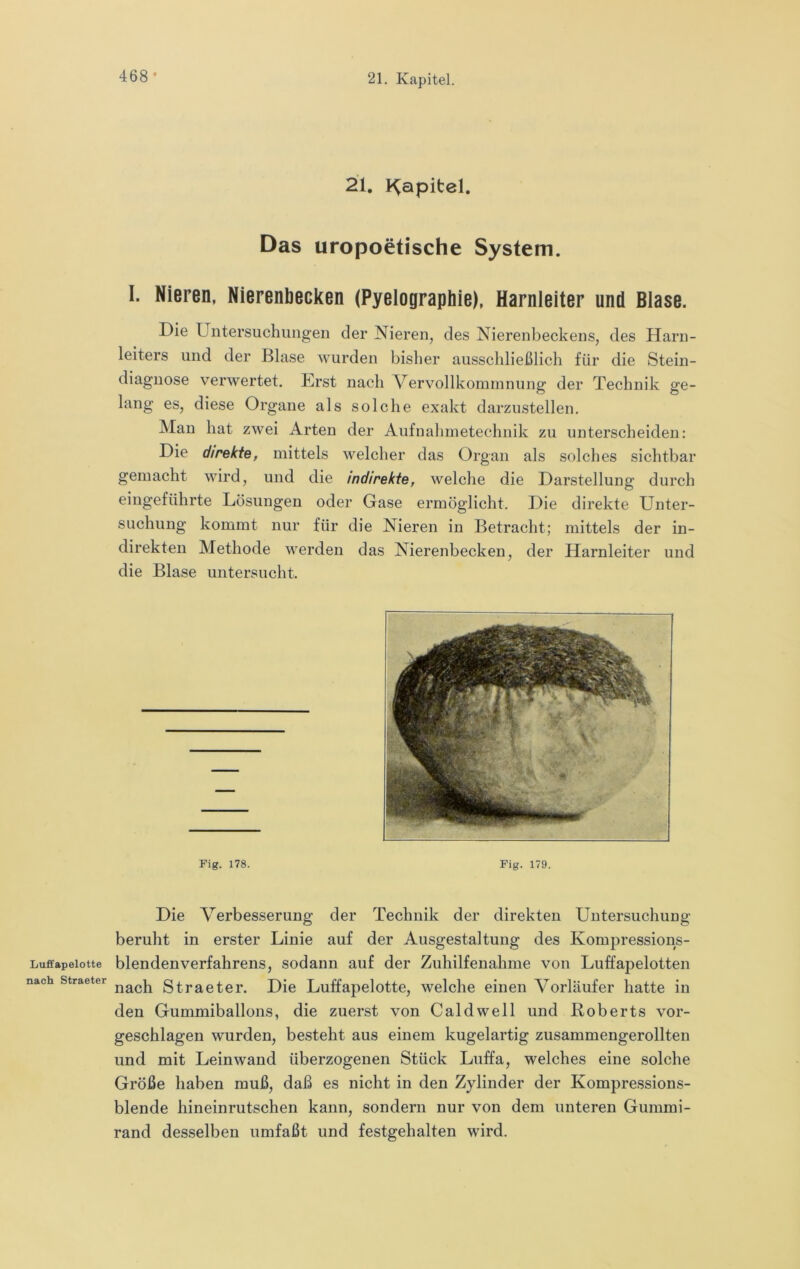 468- Luffapelotte nach Straeter 21. Kapitel. Das uropoetische System. I. Nieren, Nierenbecken (Pyelographie), Harnleiter und Blase. Die Untersuchiiiigeii der Nieren, des Nierenbeckens, des Harn- leiters und der Blase wurden bisher ausschließlich für die Stein- diagnose verwertet. Erst nach Vervollkonunnung der Technik ge- lang es, diese Organe als solche exakt darzustellen. Man hat zwei Arten der Aufnahmetechnik zu unterscheiden: Die direkte, mittels welcher das Organ als solches sichtbar gemacht wird, und die indirekte, welche die Darstellung durch eingeführte Lösungen oder Gase ermöglicht. Die direkte Unter- suchung kommt nur für die Nieren in Betracht; mittels der in- direkten Methode werden das Nierenbecken, der Harnleiter und die Blase untersucht. Fig. 178. Fig. 179. Die Verbesserung der Technik der direkten Untersuchung beruht in erster Linie auf der Ausgestaltung des Kompressions- blendenverfahrens, sodann auf der Zuhilfenahme von Luffapelotten nach Straeter. Die Luffapelotte, welche einen Vorläufer hatte in den Gummiballons, die zuerst von Caldwell und Roberts vor- geschlagen wurden, besteht aus einem kugelartig zusammengerollten und mit Leinwand überzogenen Stück Luffa, welches eine solche Größe haben muß, daß es nicht in den Zylinder der Kompressions- blende hineinrutschen kann, sondern nur von dem unteren Gummi- rand desselben umfaßt und festgehalten wird.