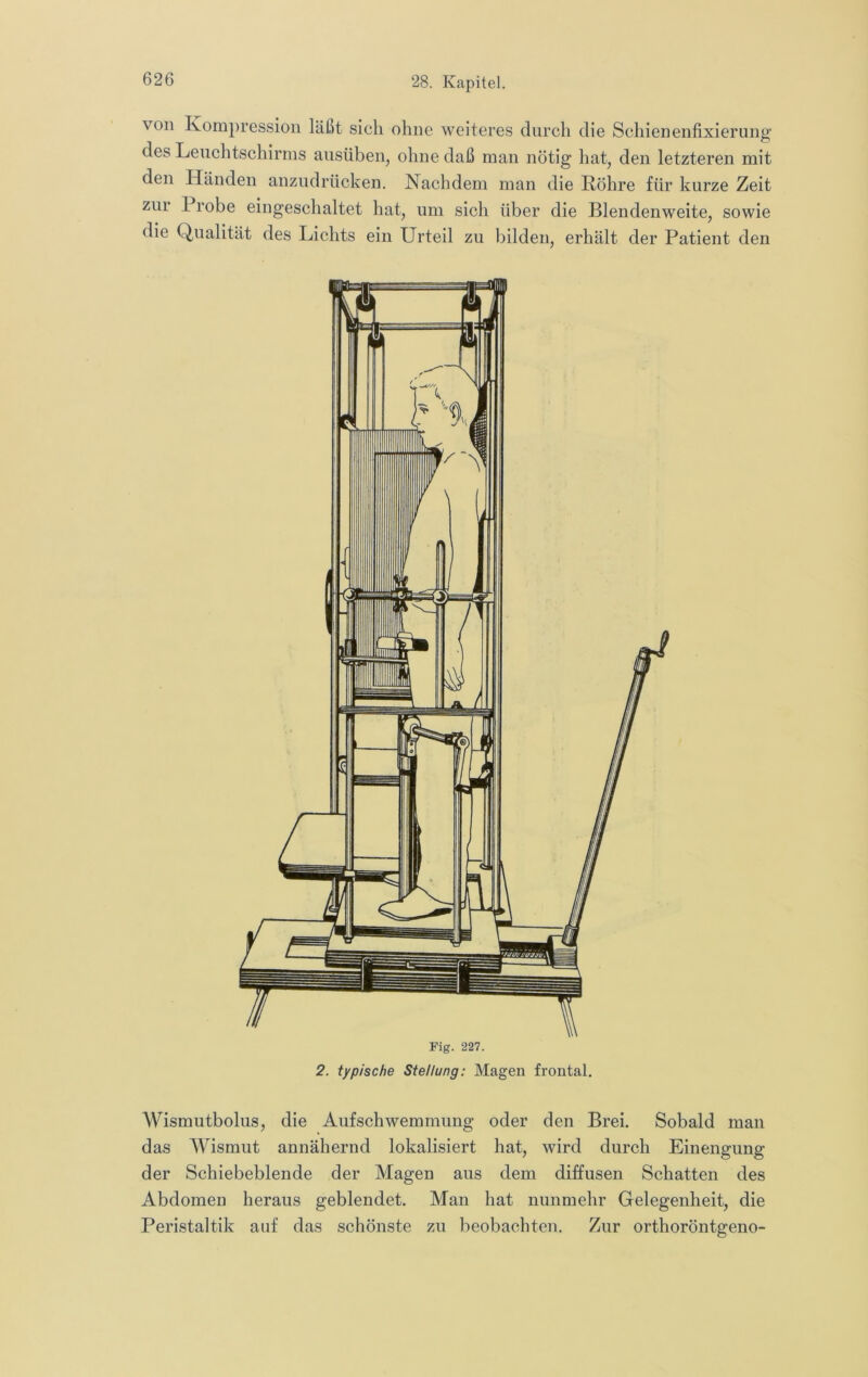 von Kompression läßt sich ohne weiteres durch die Schienenfixiernng des Leuchtschirms ausübeiij ohne daß man nötig hat, den letzteren mit den Händen anzudrücken. Nachdem man die Röhre für kurze Zeit zur 1 rohe eingeschaltet hat, um sich über die Blendenweite, sowie die Qualität des Lichts ein Urteil zu bilden, erhält der Patient den 2. typische Stellung: Magen frontal. Wismutbolus, die Aufschwemmung oder den Brei. Sobald man das Wismut annähernd lokalisiert hat, wird durch Einengung der Schiebeblende der Magen aus dem diffusen Schatten des Abdomen heraus geblendet. Man hat nunmehr Gelegenheit, die Peristaltik auf das schönste zu beobachten. Zur orthoröntgeno-