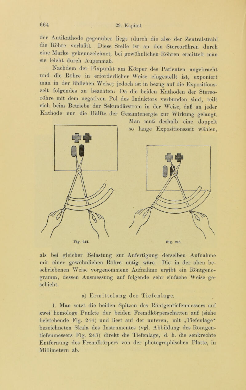 der Antikathode gegenüber liegt (durch die also der Zentralstrahl die Röhre verläßt). Riese Stelle ist an den Stereoröhren durch eine Marke gekennzeichnet, bei gewöhnlichen Röhren ermittelt man sie leicht durch Augenmaß. Nachdem der b ixpunkt am Körper des Patienten angebracht und die Röhre in erforderlicher AVeise eingestellt ist, exponiert man in der üblichen A¥eise; jedoch ist in bezug auf die Expositions- zeit folgendes zu beachten: Ra die beiden Kathoden der Stereo- röhre mit dem negativen Pol des Induktors verbunden sind, teilt sich beim Betriebe der Sekundärstrom in der Weise, daß an jeder Kathode nur die Hälfte der Gesamtenergie zur AVirkung gelangt. Man muß deshalb eine doppelt so lange Expositionszeit wählen. als bei gleicher Belastung zur Anfertigung derselben Aufnahme mit einer gewöhnlichen Röhre nötig wäre. Die in der oben be- schriebenen A¥eise vorgenommene Aufnahme ergibt ein Röntgeno- gramm, dessen Ausmessung auf folgende sehr einfache AVeise ge- schieht. a) Ermittelung der Tiefenlage. 1. Man setzt die beiden Spitzen des Röntgentiefenmessers auf zwei homologe Punkte der beiden Fremdkörperschatten auf (siehe beistehende Fig. 244) und liest auf der unteren, mit „Tiefenlage“ bezeichneten Skala des Instrumentes (vgl. Abbildung des Röntgen- tiefenmessers Fig. 243) direkt die Tiefenlage, d. h. die senkrechte Entfernung des Fremdkörpers von der photographischen Platte, in Millimetern ab.